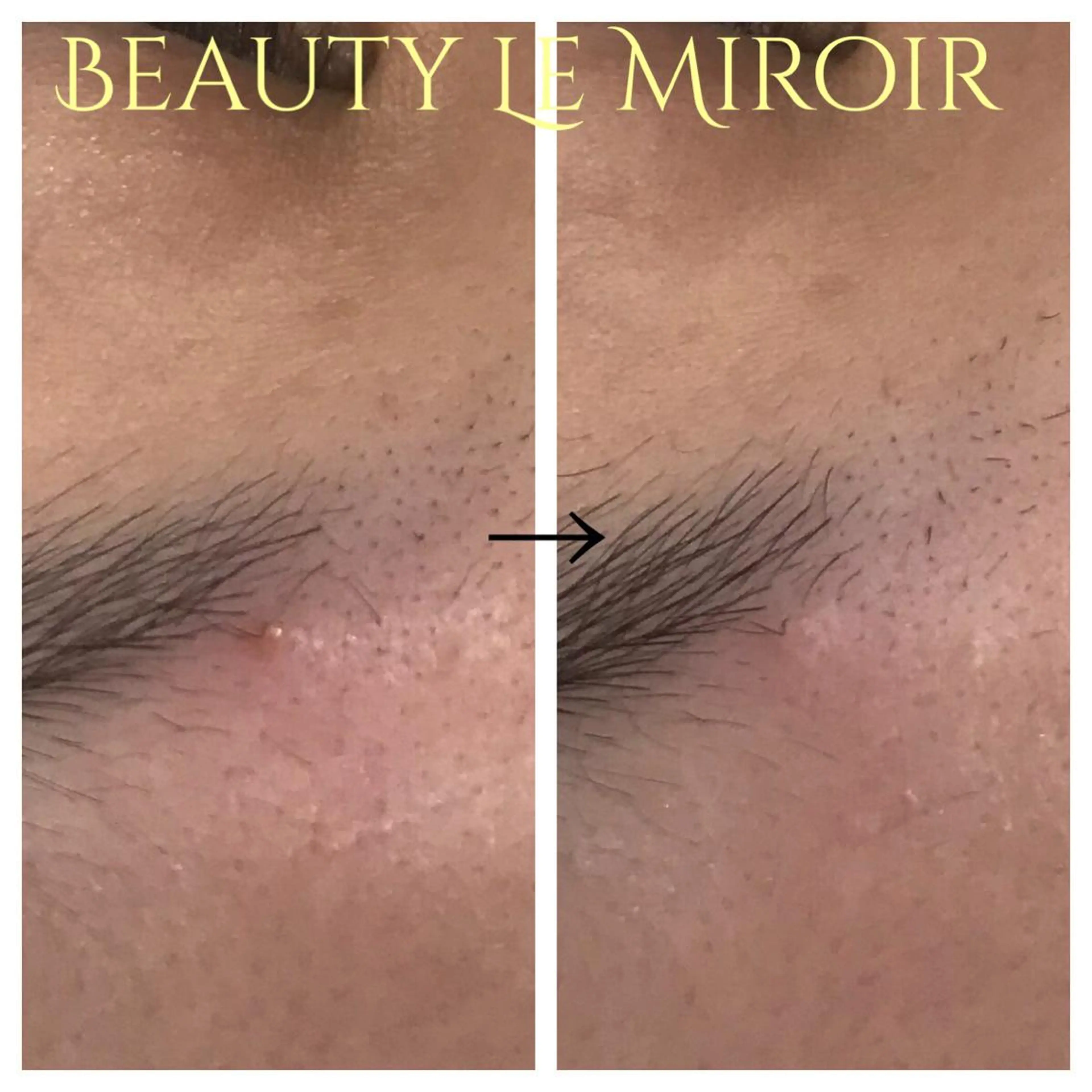 ビューティー ミロワールのエステ・リラクイメージ