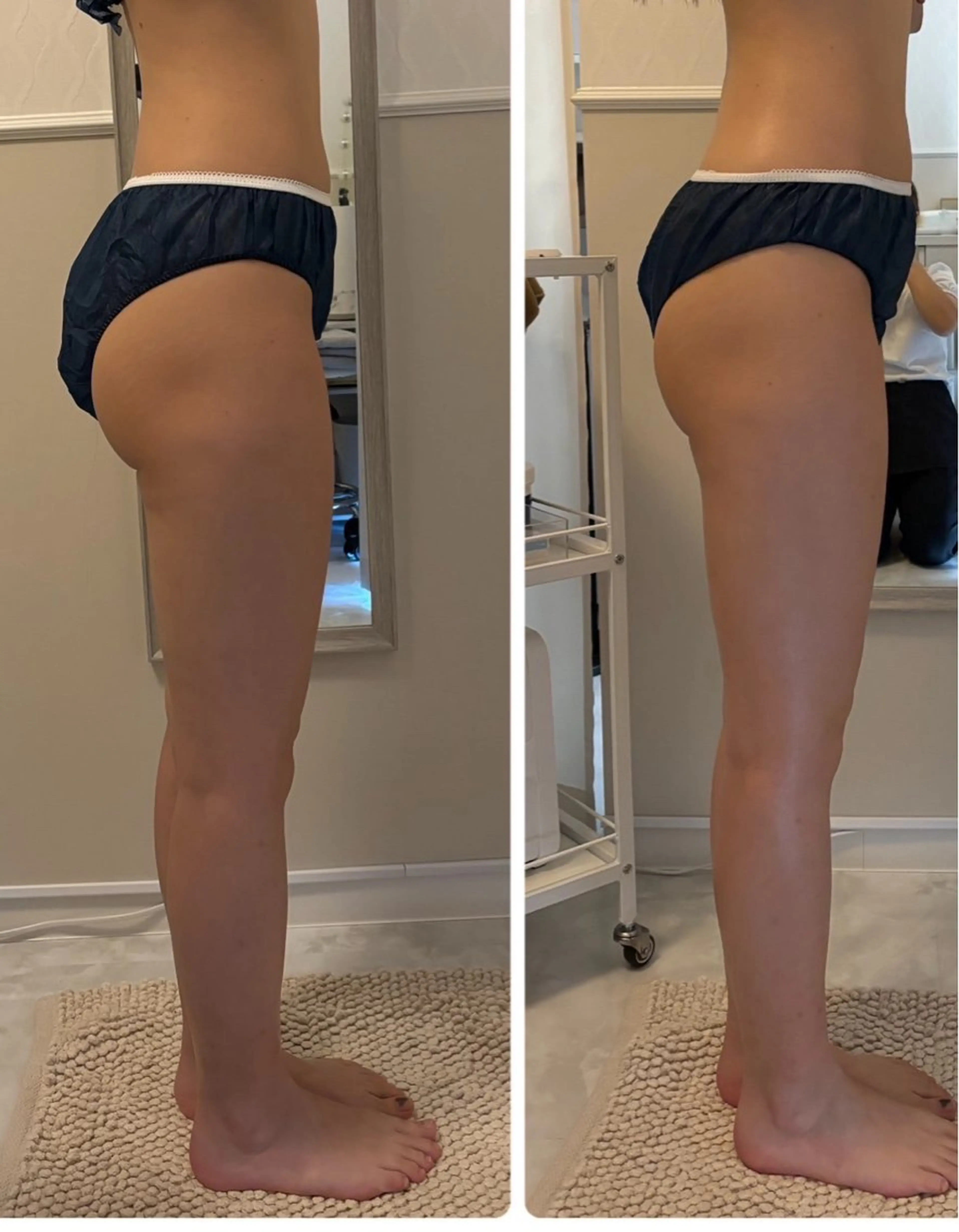 esthesalon Ran所属・小顔美肌痩身サロン Ranのその他イメージ