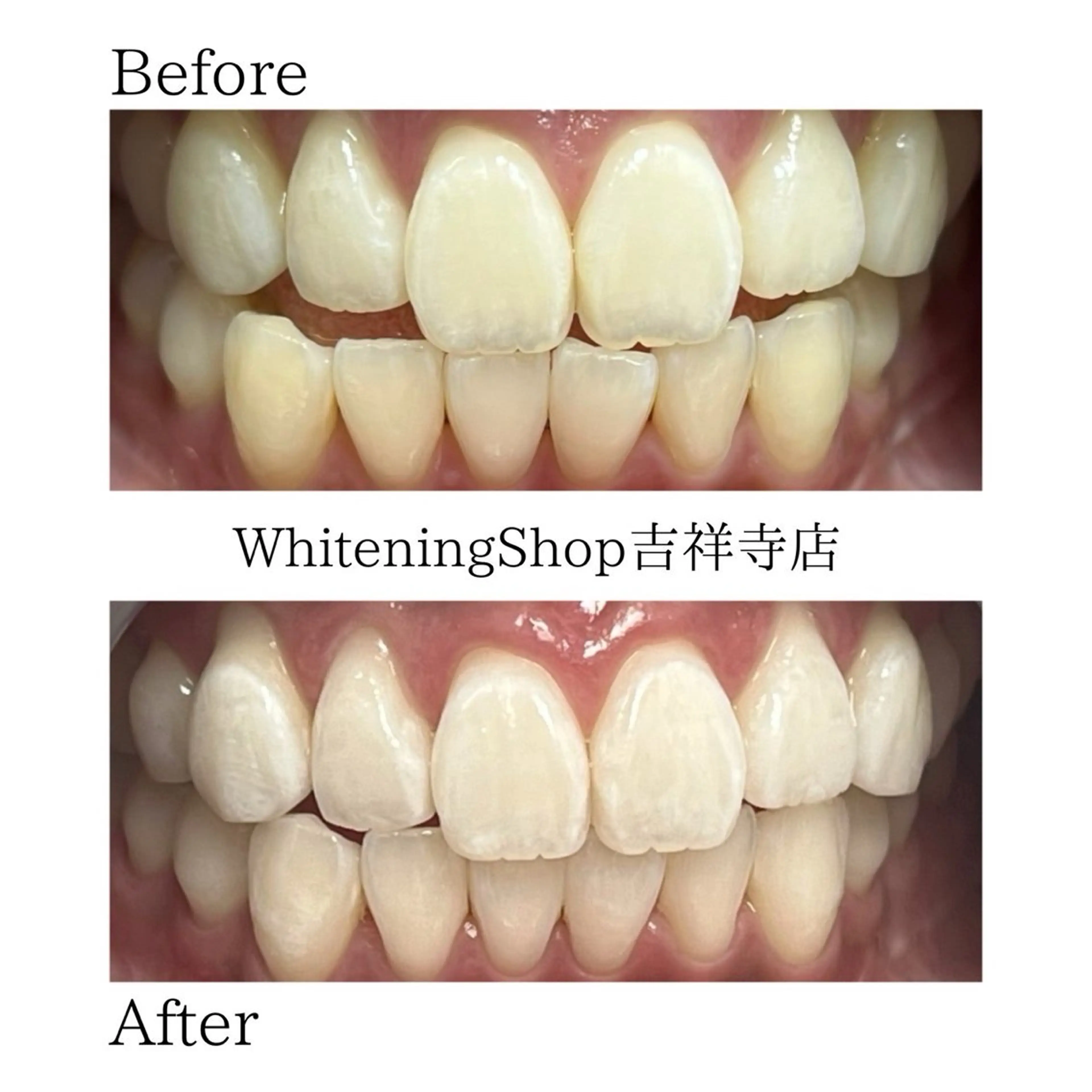 エステ リラク ホワイトニング ショップ吉祥寺店のエステ・リラクイメージ