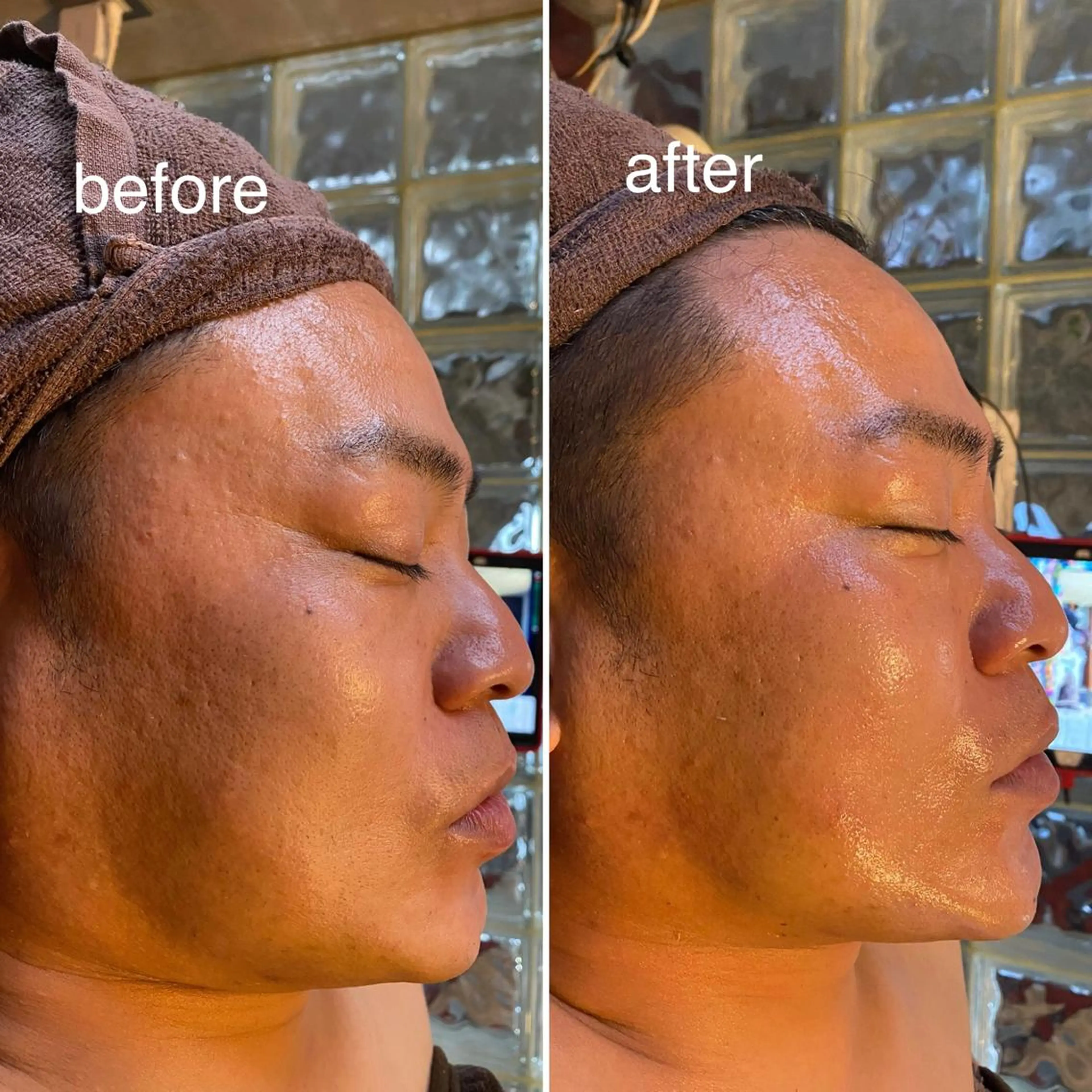 Ring -femのエステ・リラクイメージ