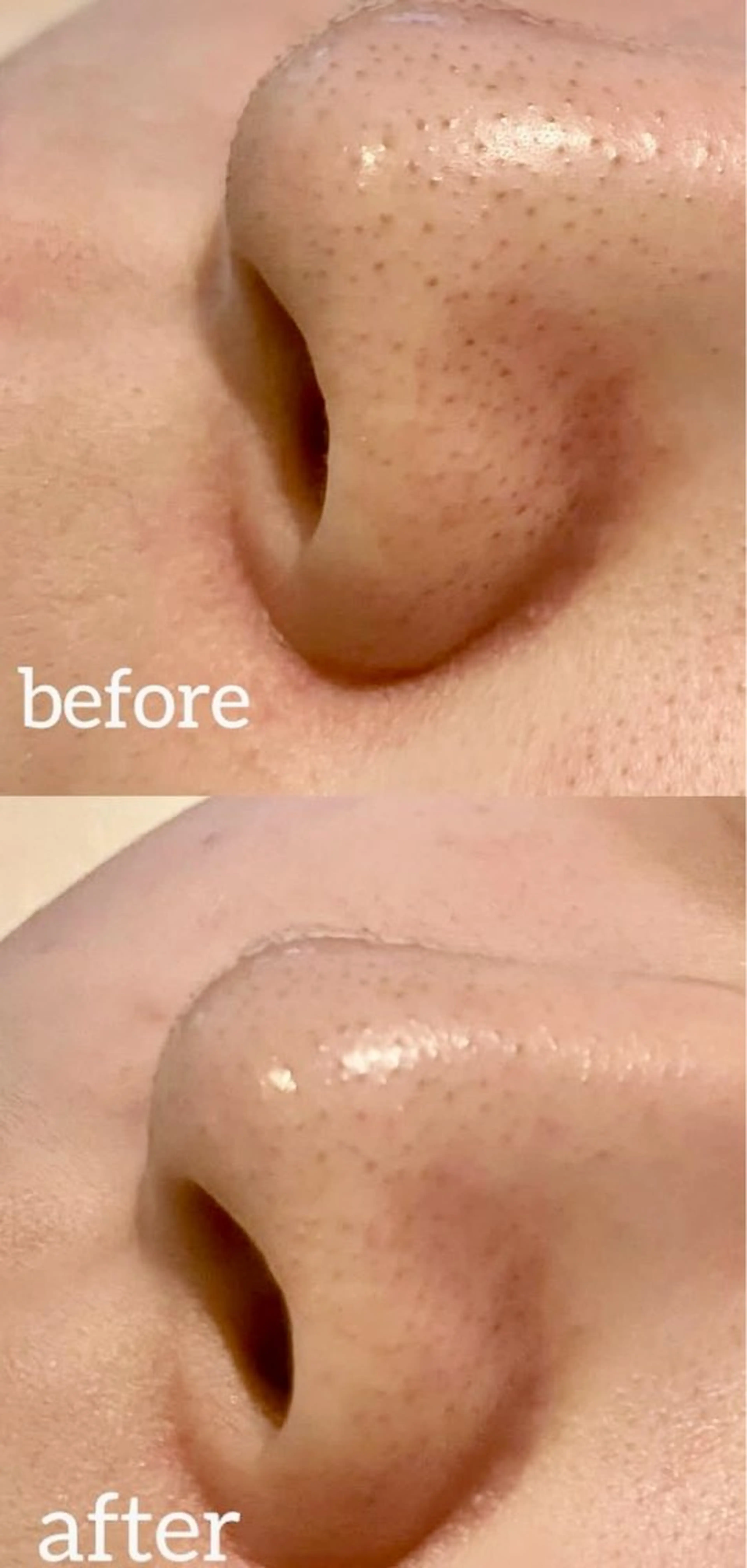 🧸Ｈirano Ｙasue🐾のエステ・リラクイメージ