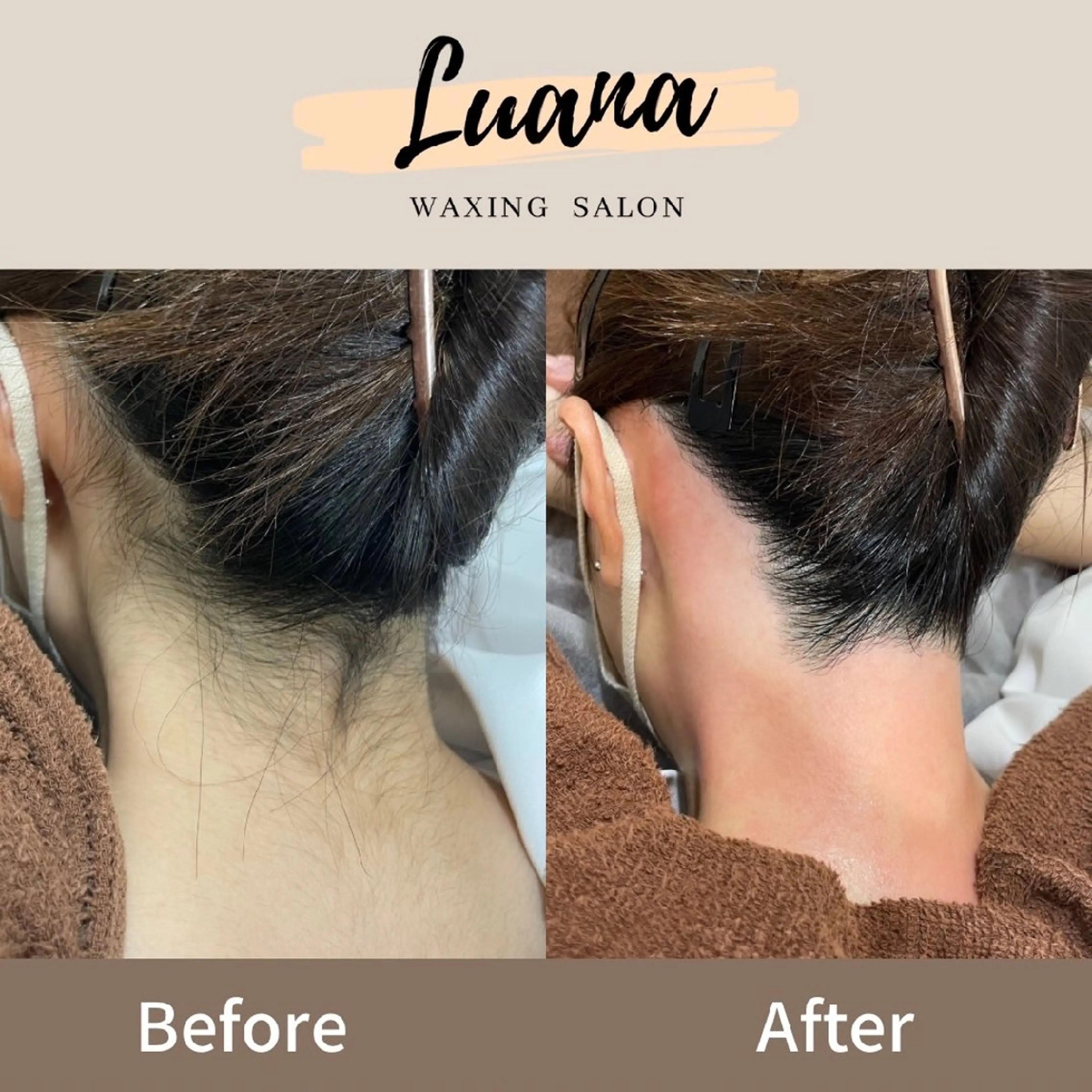 脱毛 Luana waxing salon所属・Luana wax 🐚根本のエステ・リラクイメージ