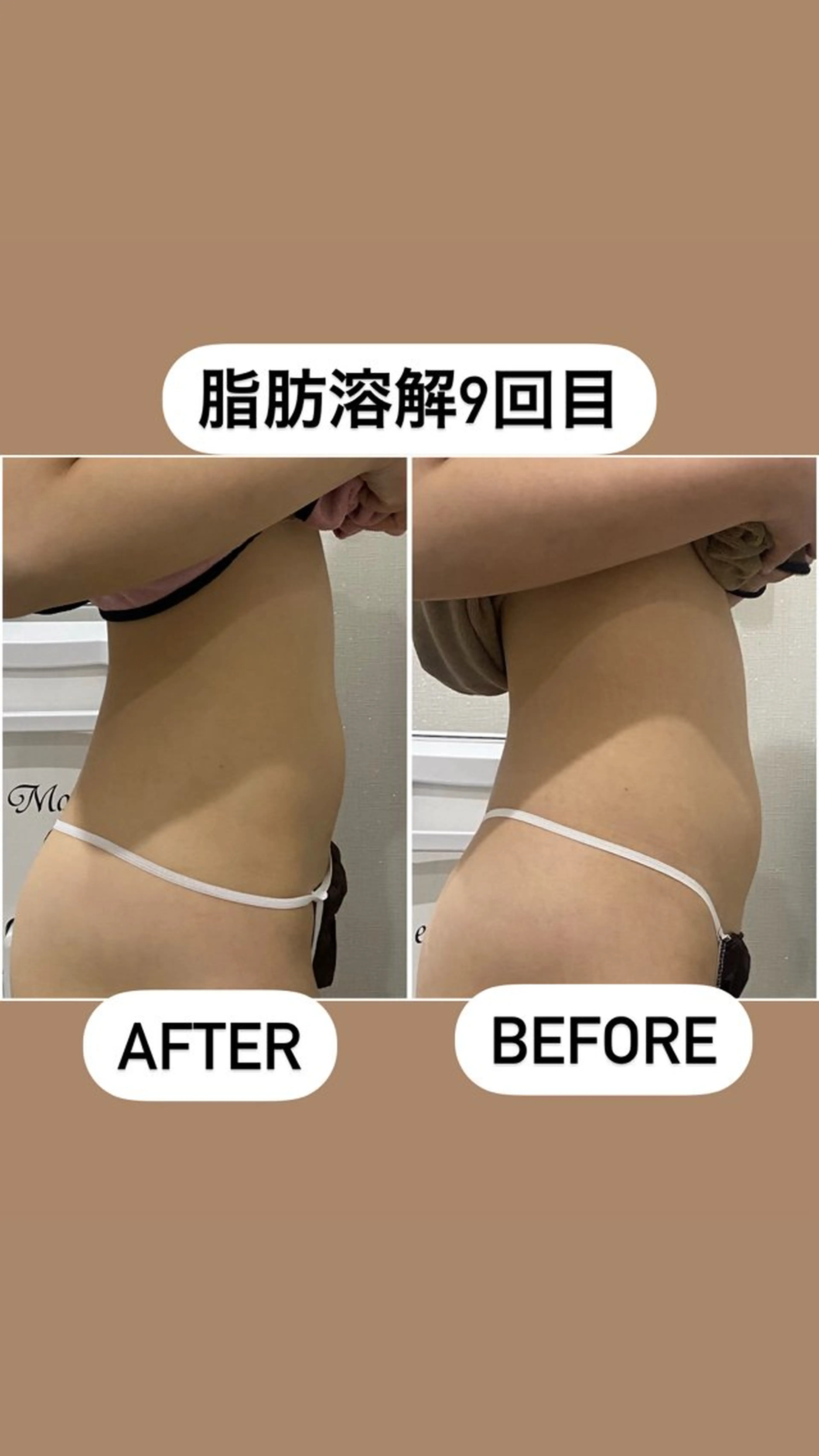 エステ 毛穴洗浄・痩身・脱毛 /アルカンジュのエステ・リラクイメージ