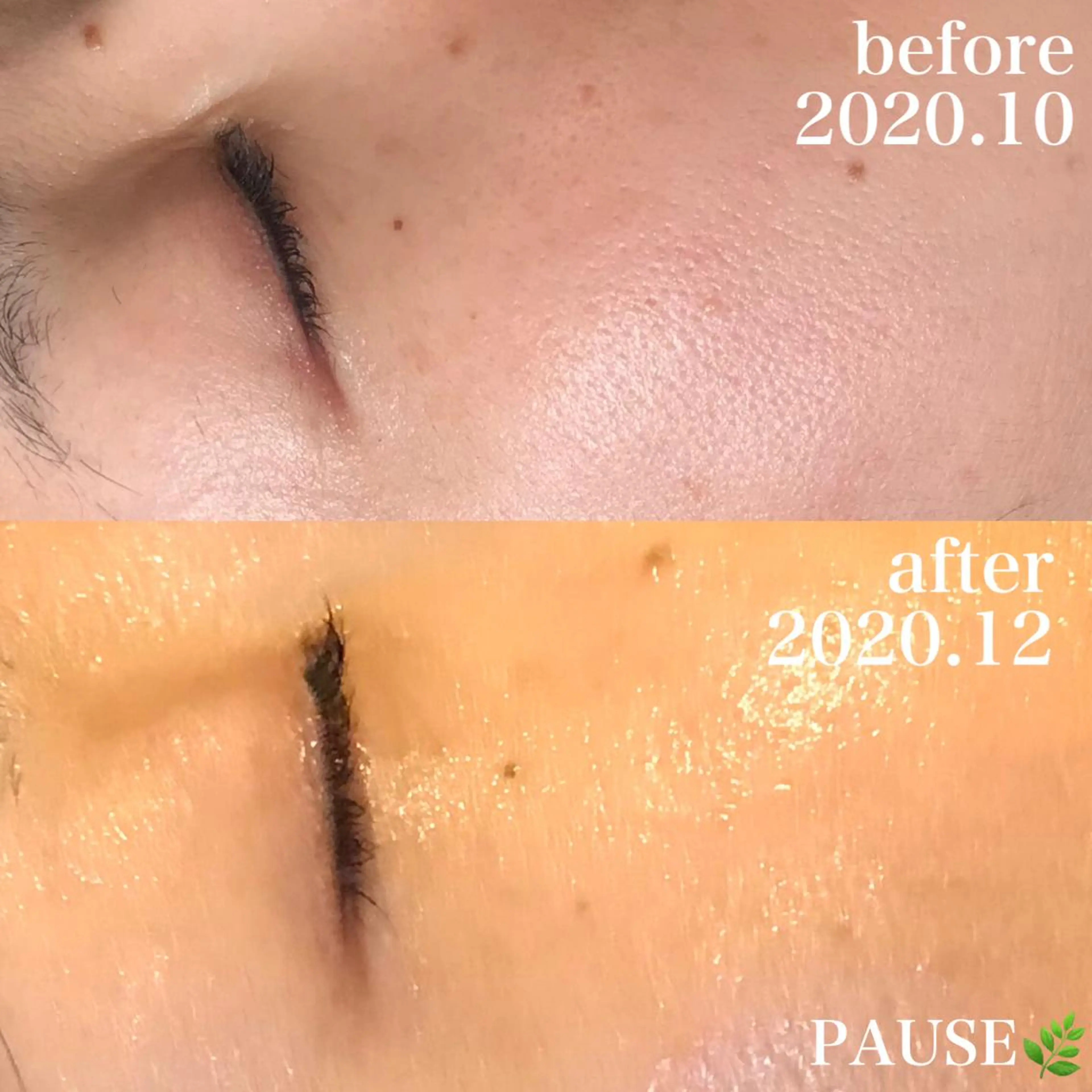 エステ 浜野 恵美のエステ・リラクイメージ