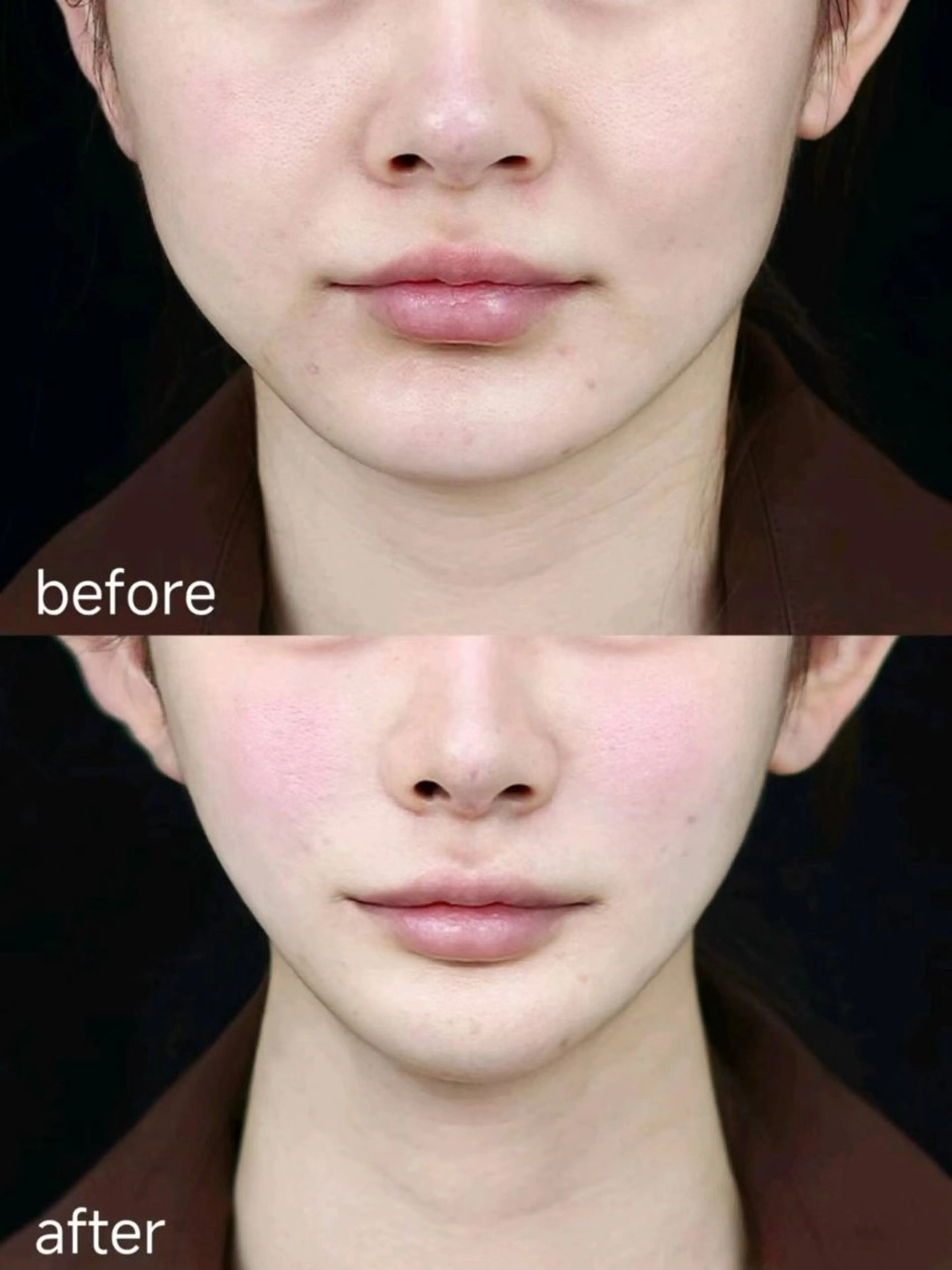 マツエク・マツパ エステ aliaハイフ&水光ジェットサロン所属・aliaハーブ水光店 エステティシャン募集のエステ・リラクイメージ