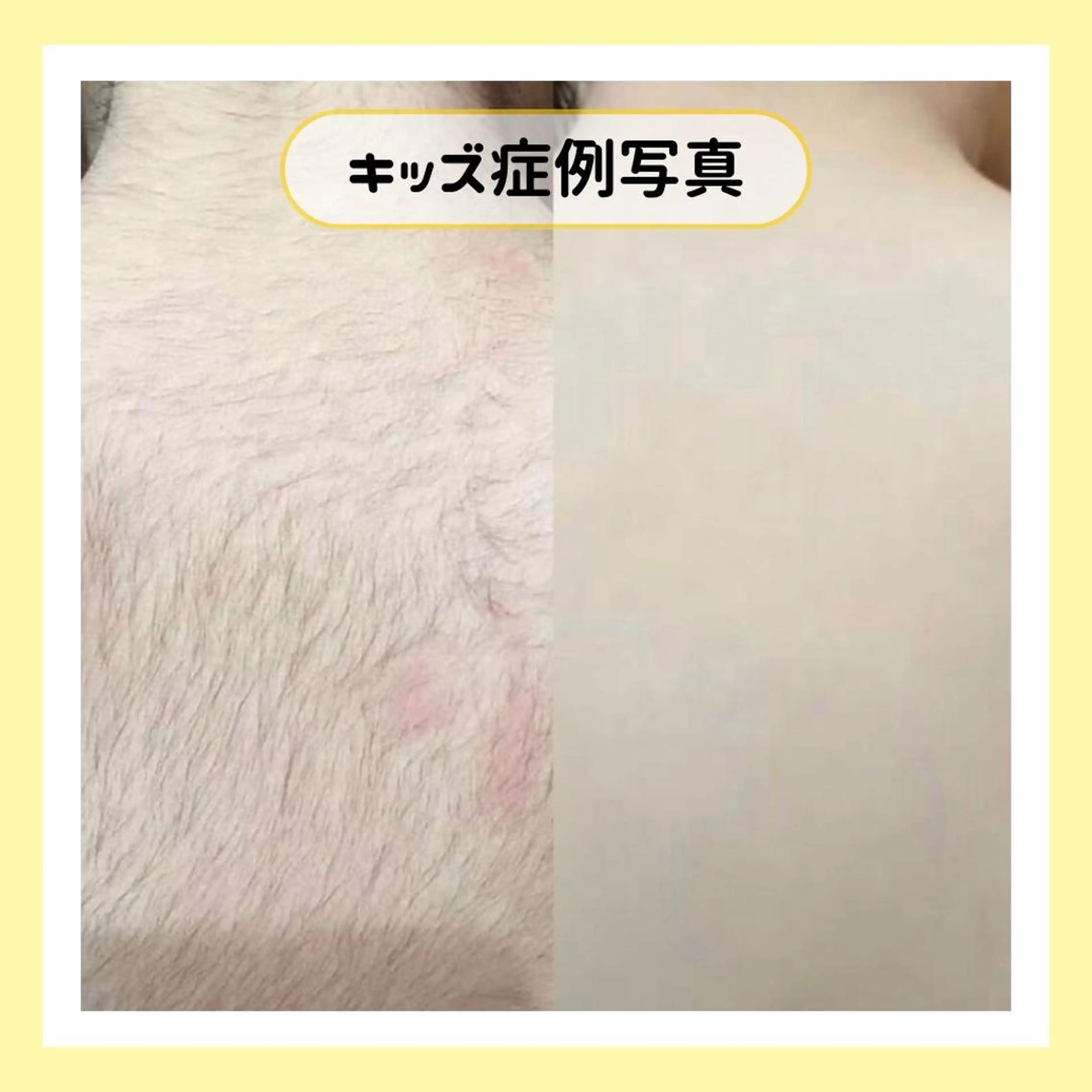 金山/脱毛/美肌 ULULUのエステ・リラクイメージ