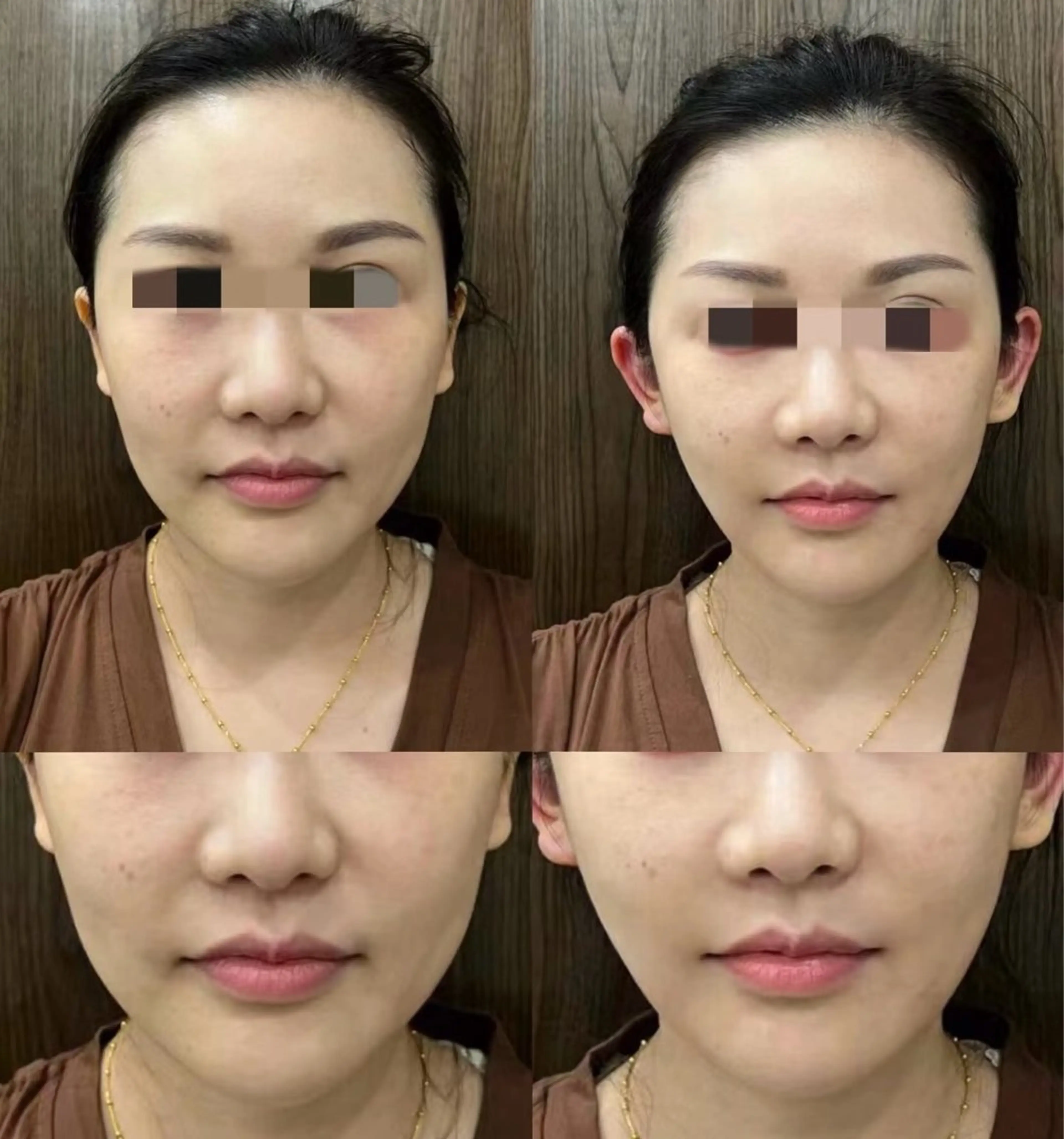 マツエク・マツパ エステ aliaハイフ&水光ジェットサロン所属・aliaハーブ水光店 エステティシャン募集のエステ・リラクイメージ