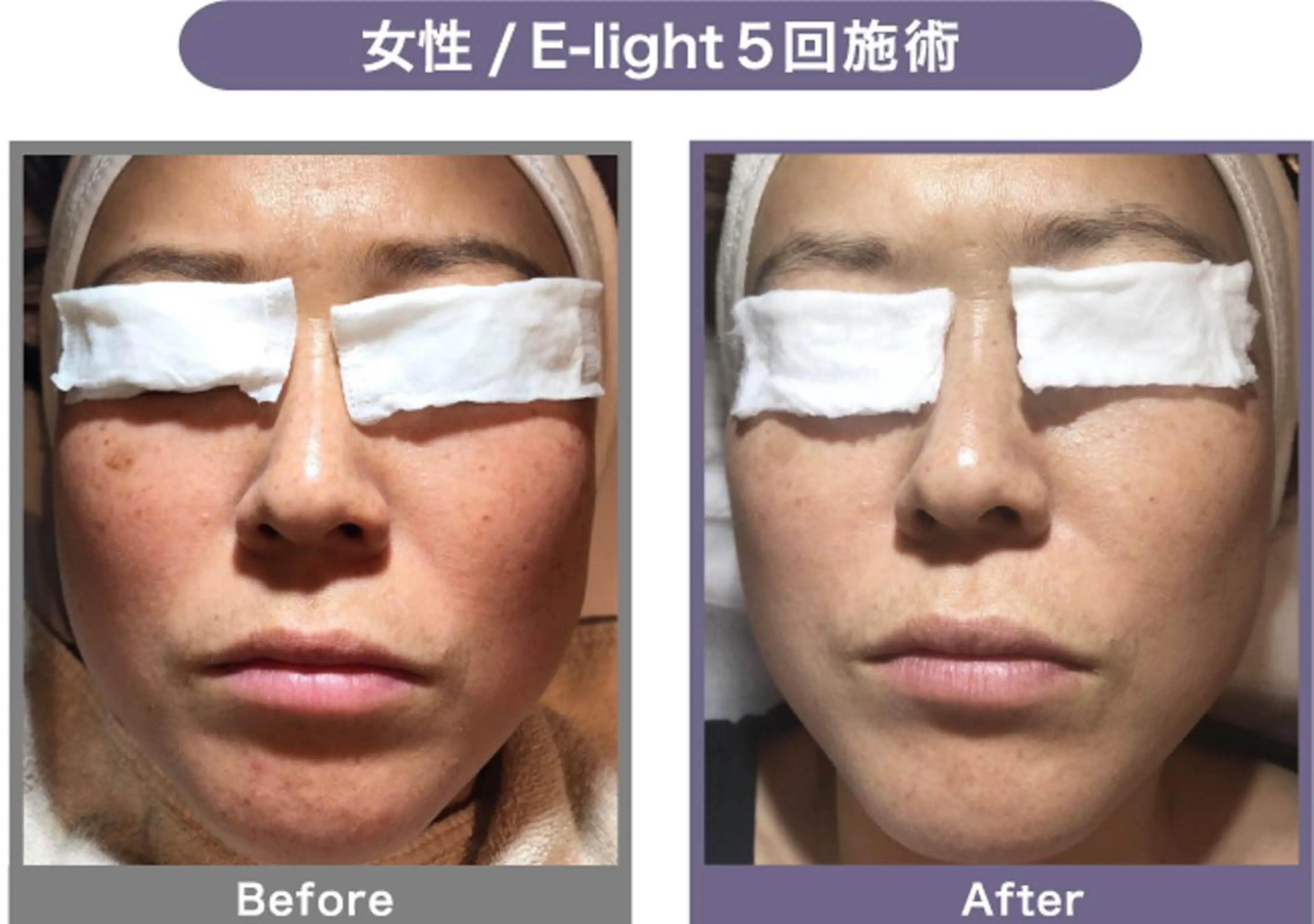 NONOKEKE ノノケケのエステ・リラクイメージ