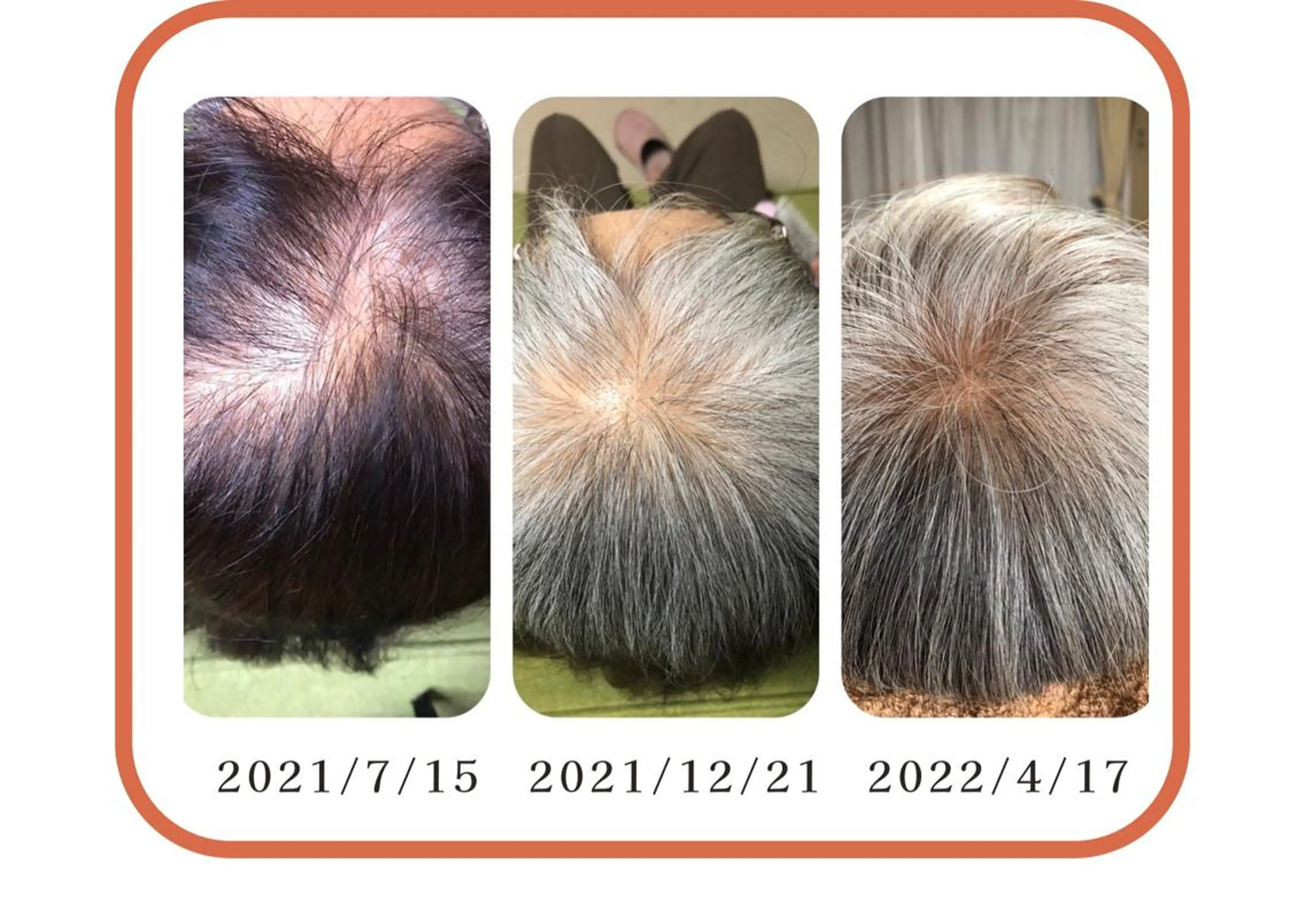 かすがい鍼灸院Re.heart所属・かすがい鍼灸院 Re.heartのエステ・リラクイメージ