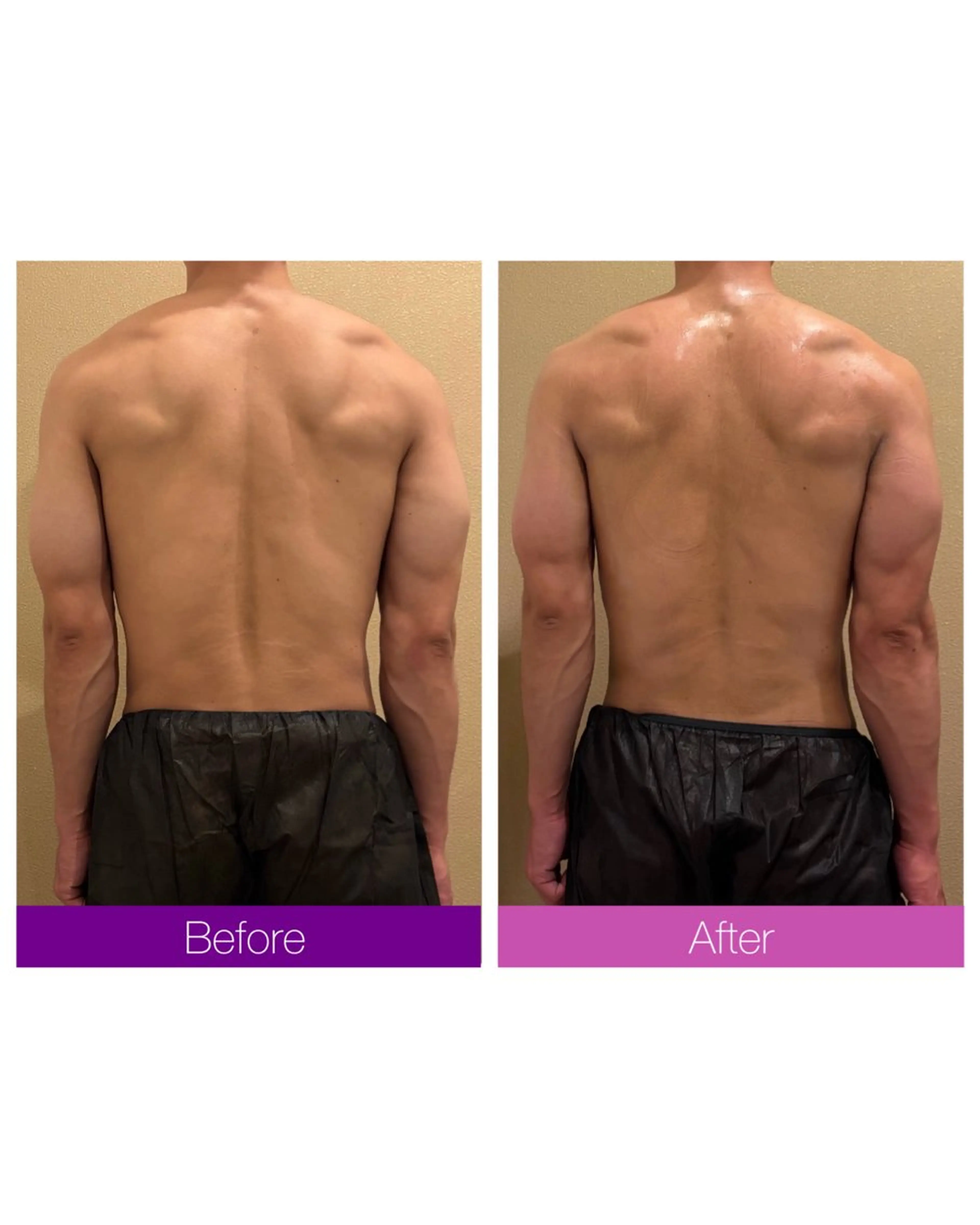 ☆痩身/小顔☆ 結果出します☆のエステ・リラクイメージ