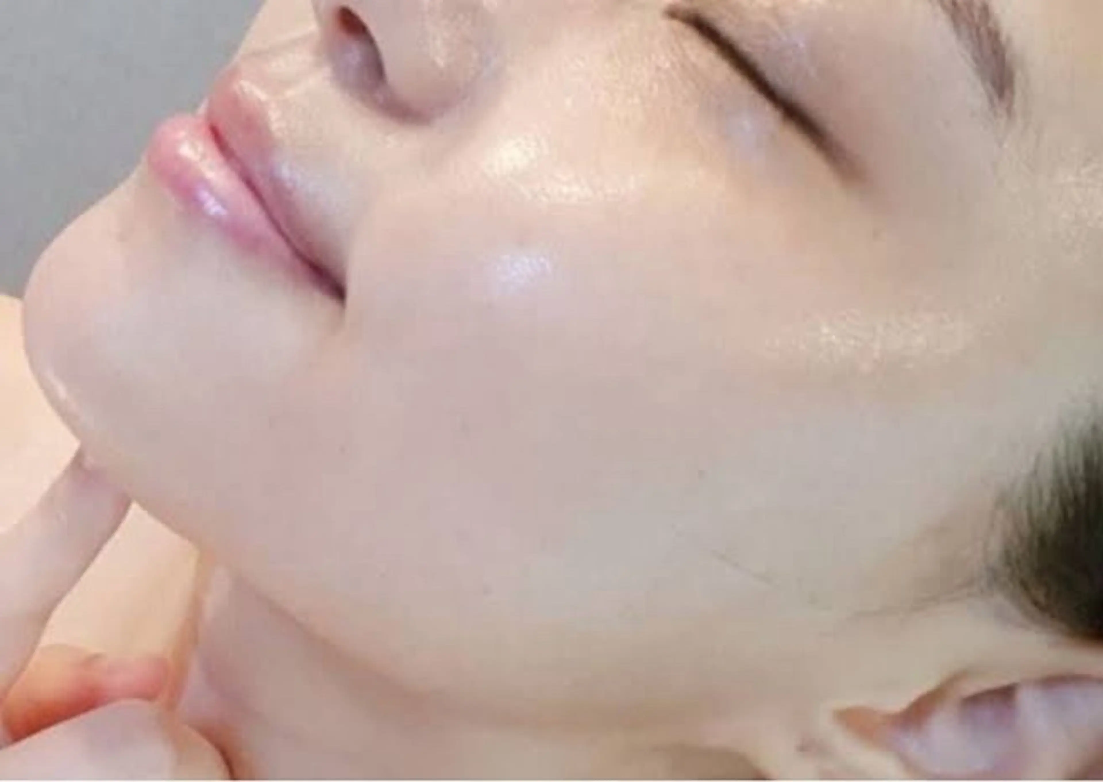 🍬minimo限定価格🍬【韓国女優肌を目指すなら⭐️】　最新美容機器とピーリングを組み合わせた贅沢コースの写真