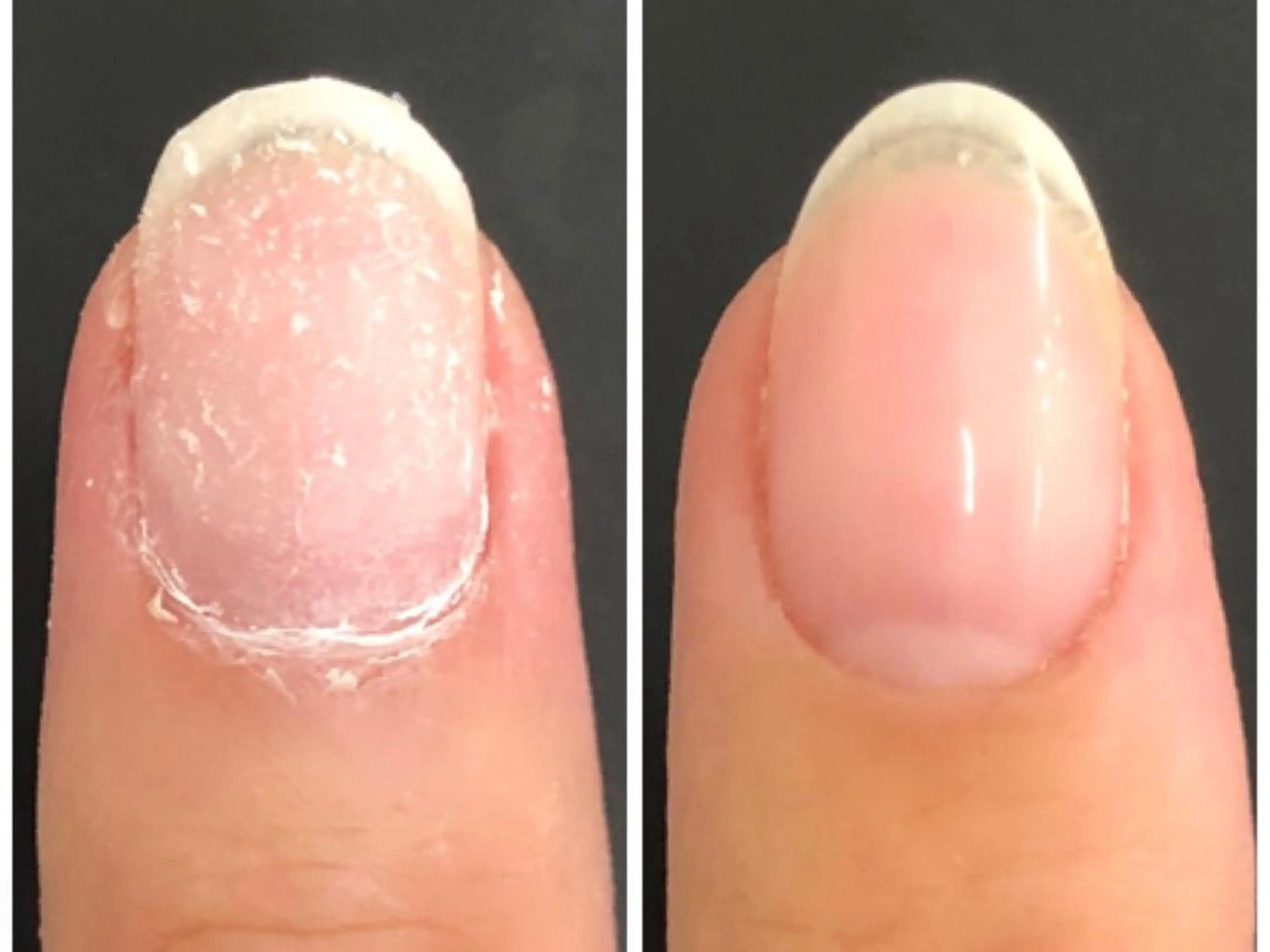 【当店のジェルオフのみ】の写真