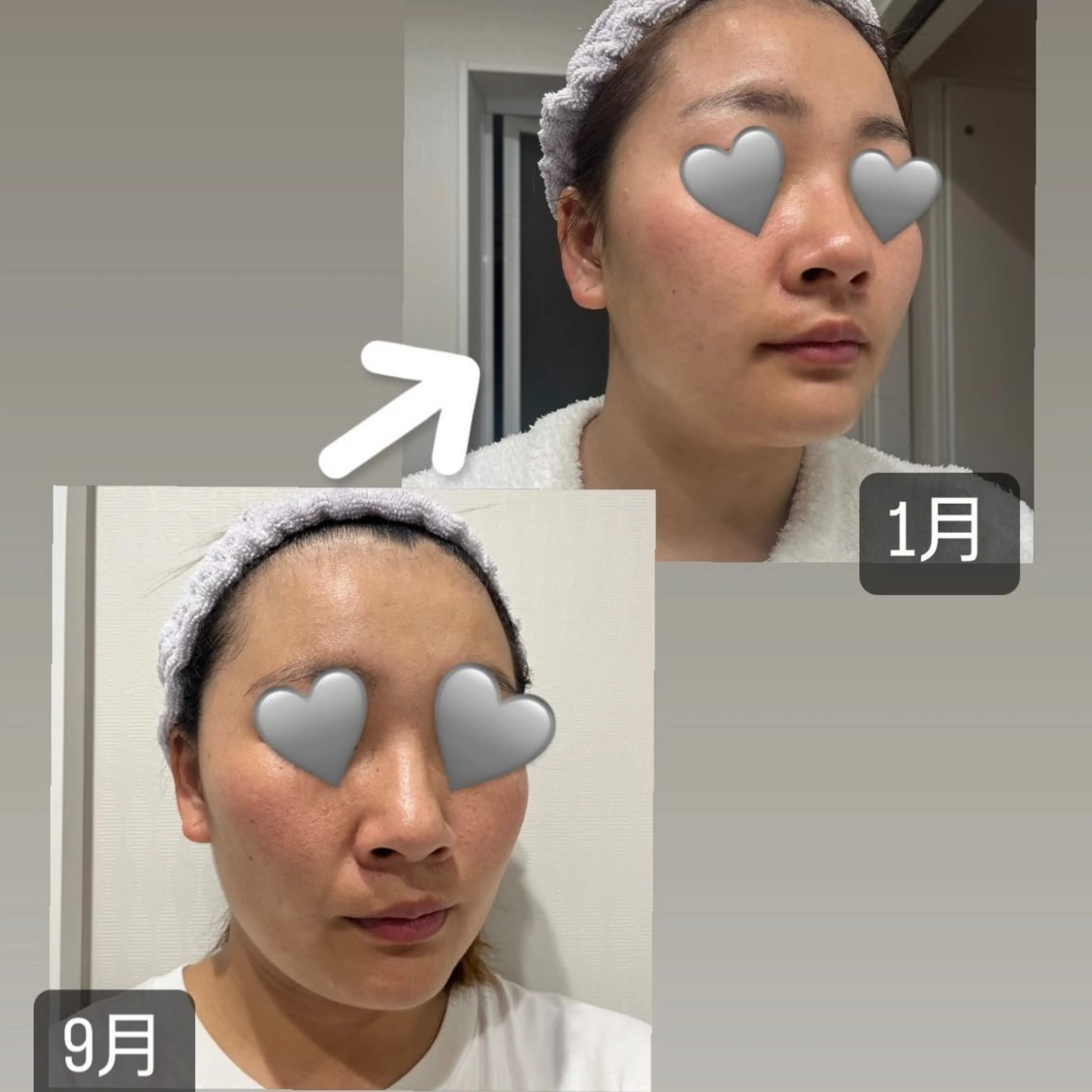 メナードフェイシャルサロン鳳北町所属・鳳北町 森田はるかのエステ・リラクイメージ