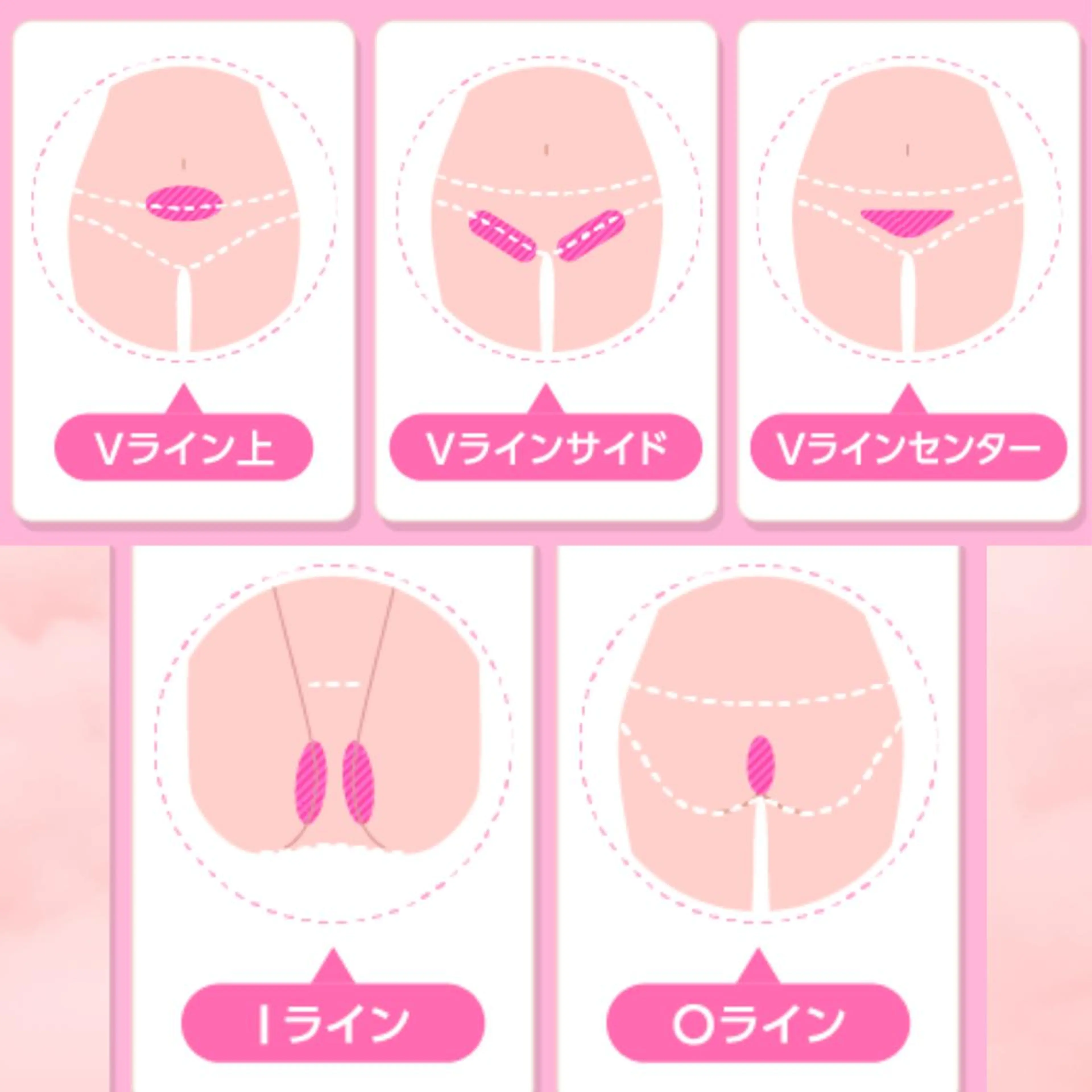 🌿小顔・痩身・脱毛 レイビス川崎店🌿のエステ・リラクイメージ