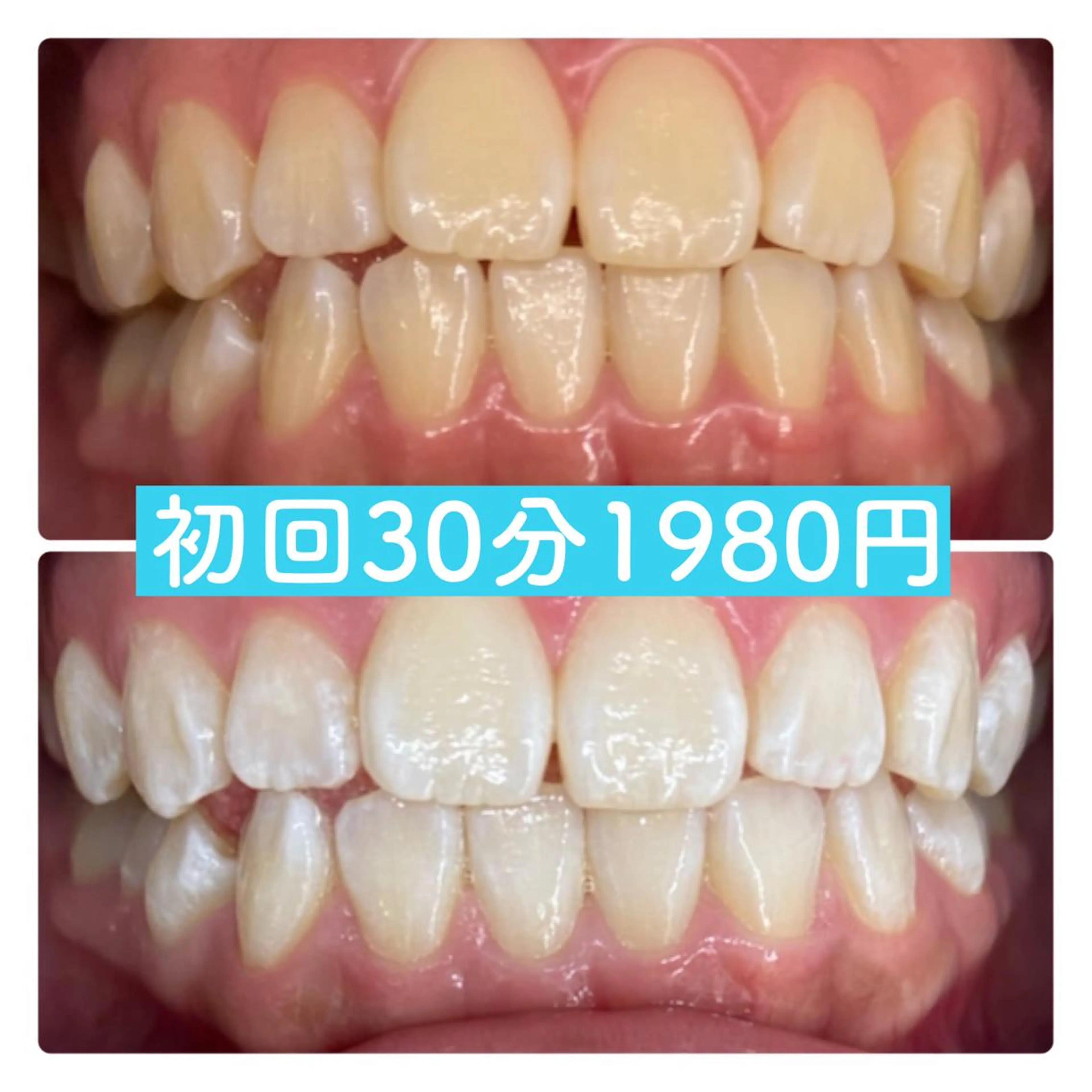 エステ PLATINUM Beauty 横浜店所属・ホワイトニングルーム 横浜店のその他イメージ