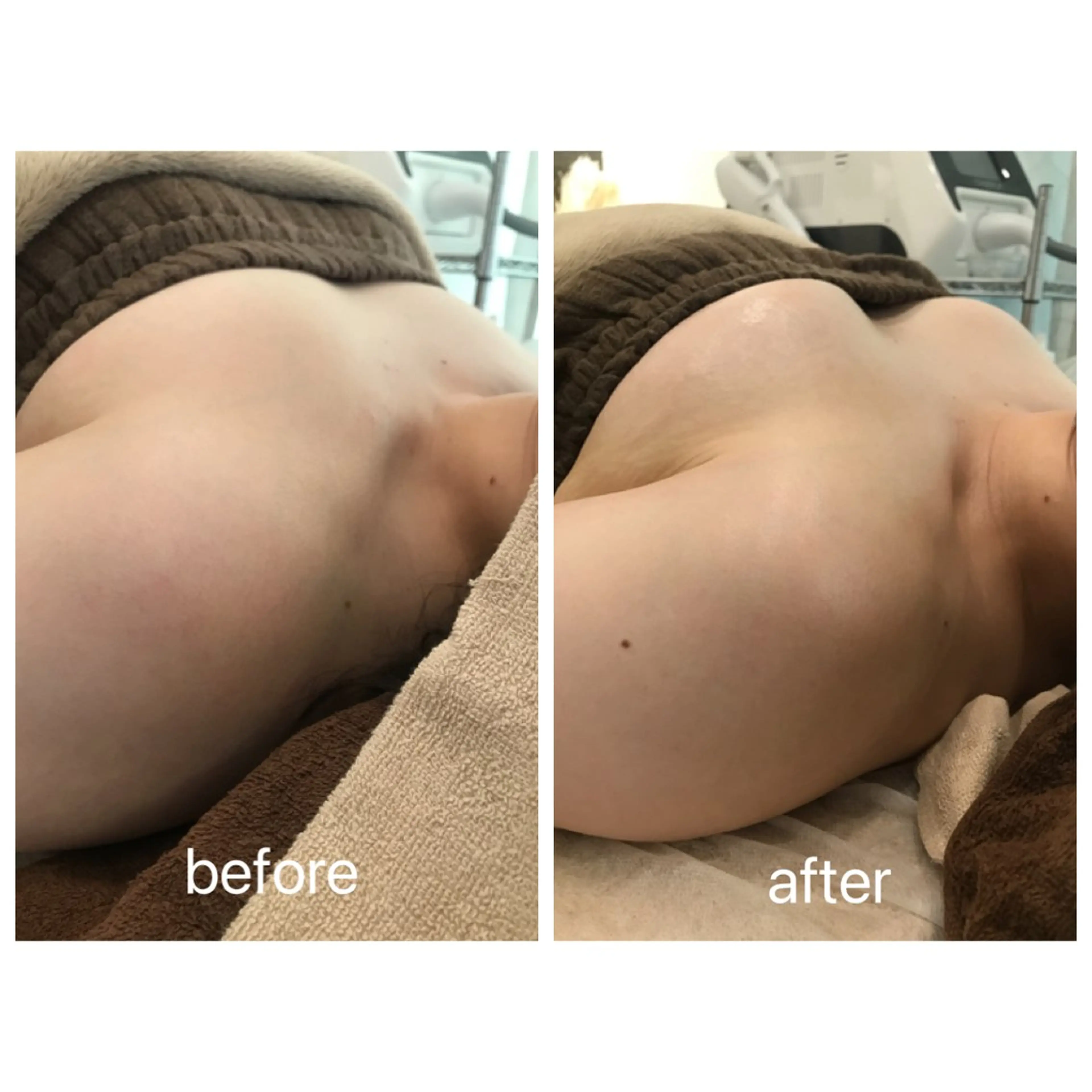 ボンボンバスト❤︎の写真