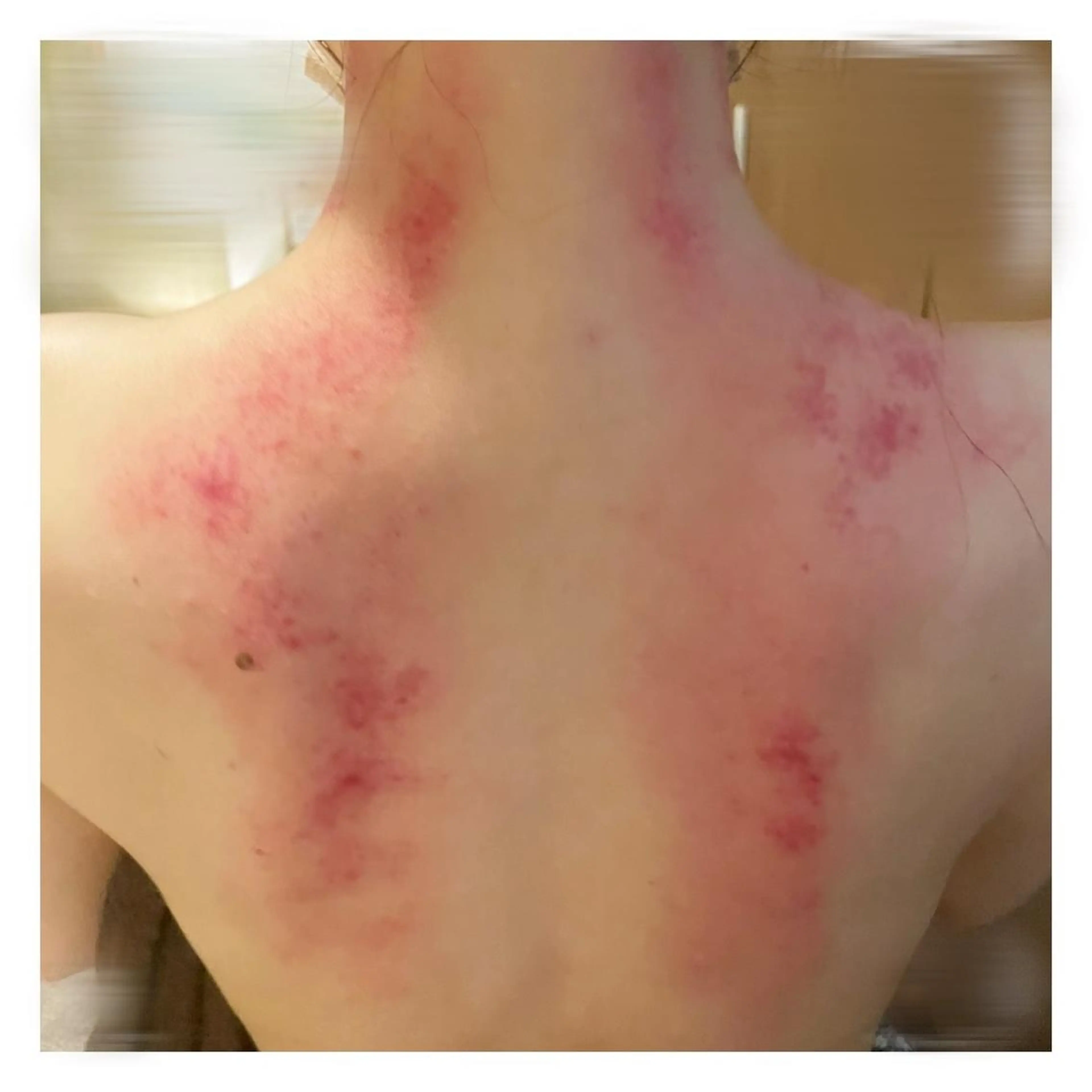 美腸専門 漢方よもぎ蒸しのエステ・リラクイメージ