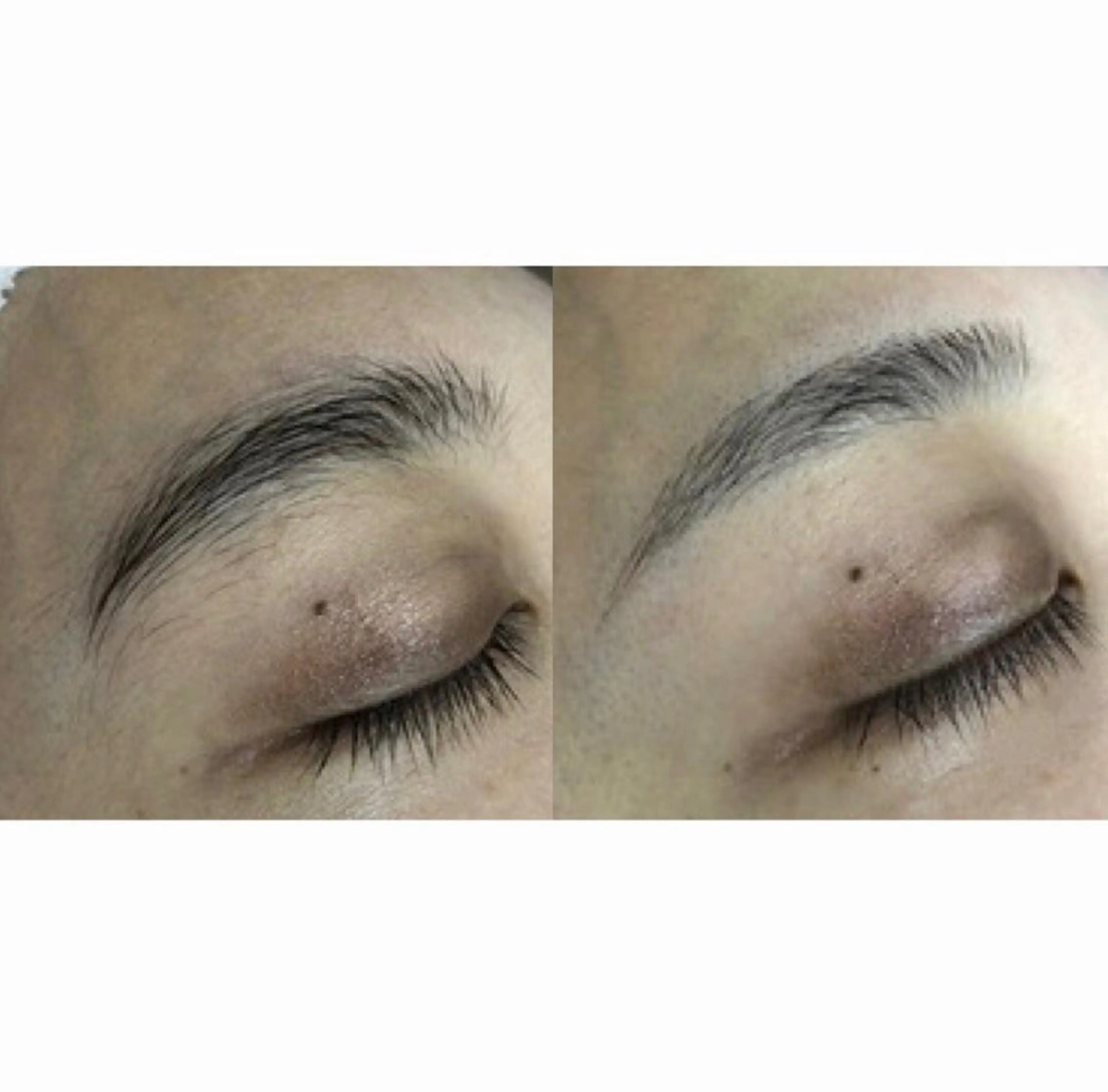 顔、襟レディースシェービング(女性限定)の写真