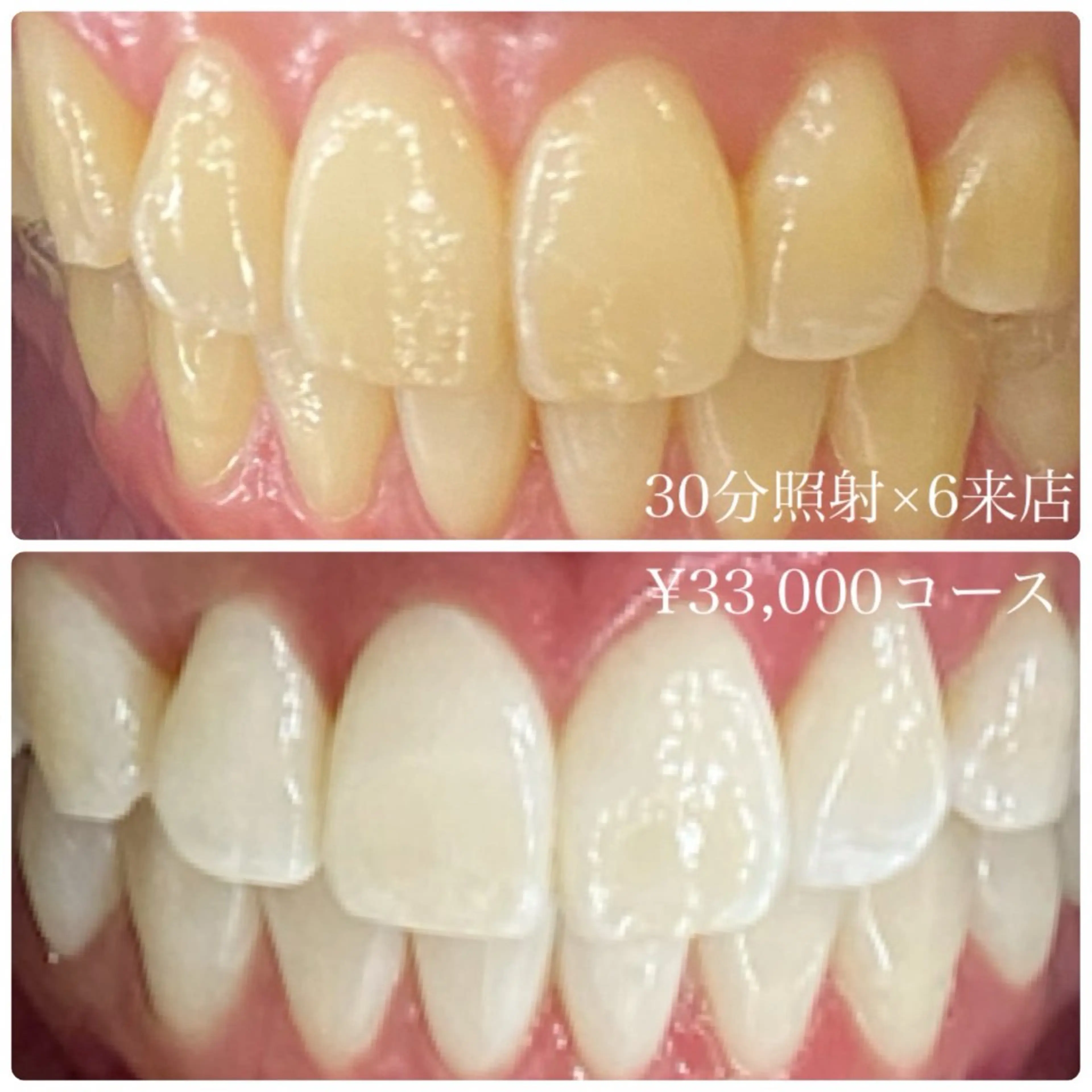 その他 PLATINUM Beauty 横浜店所属・ホワイトニングルーム 横浜店のその他イメージ