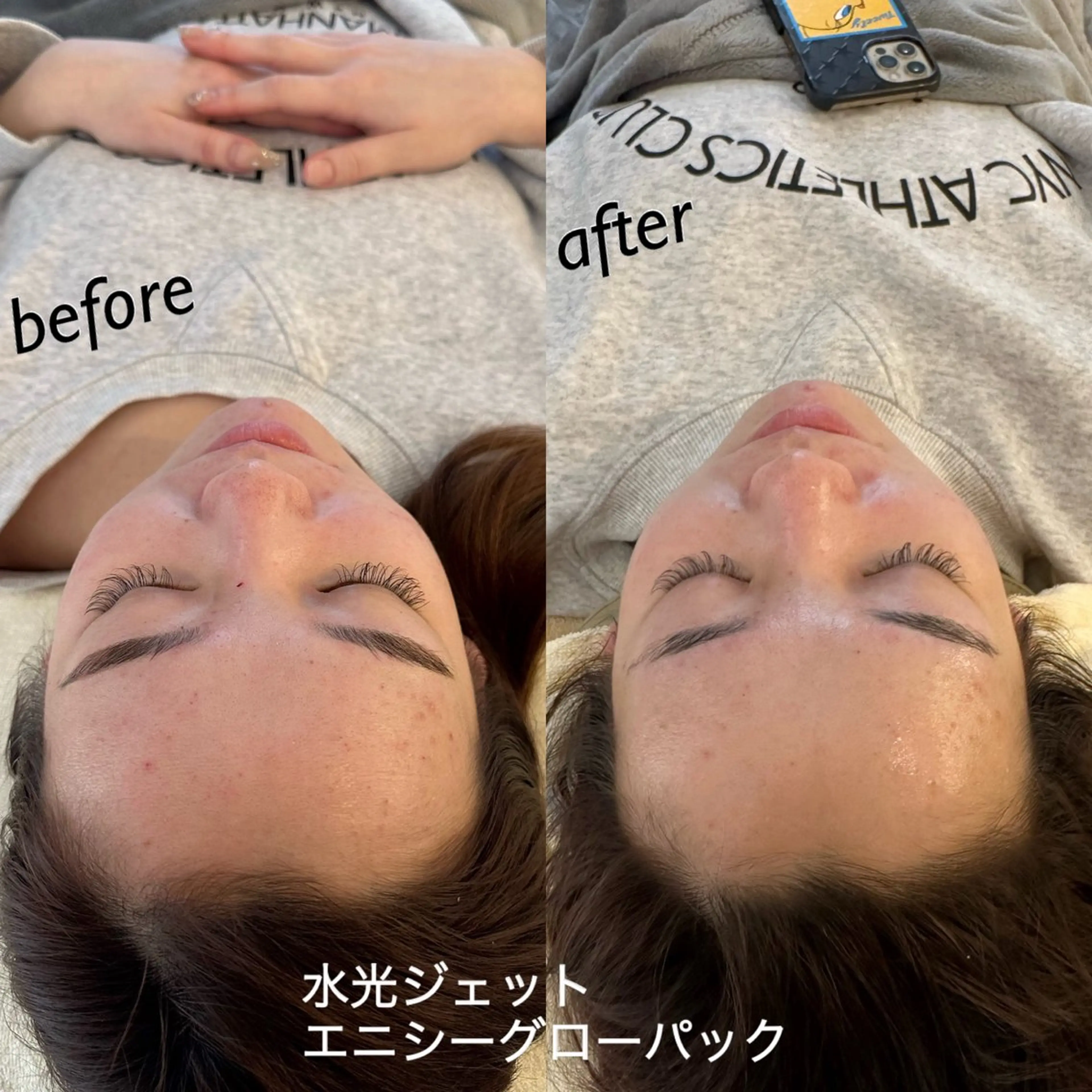 エステ うなじ脱毛/美肌脱毛 LABELのエステ・リラクイメージ