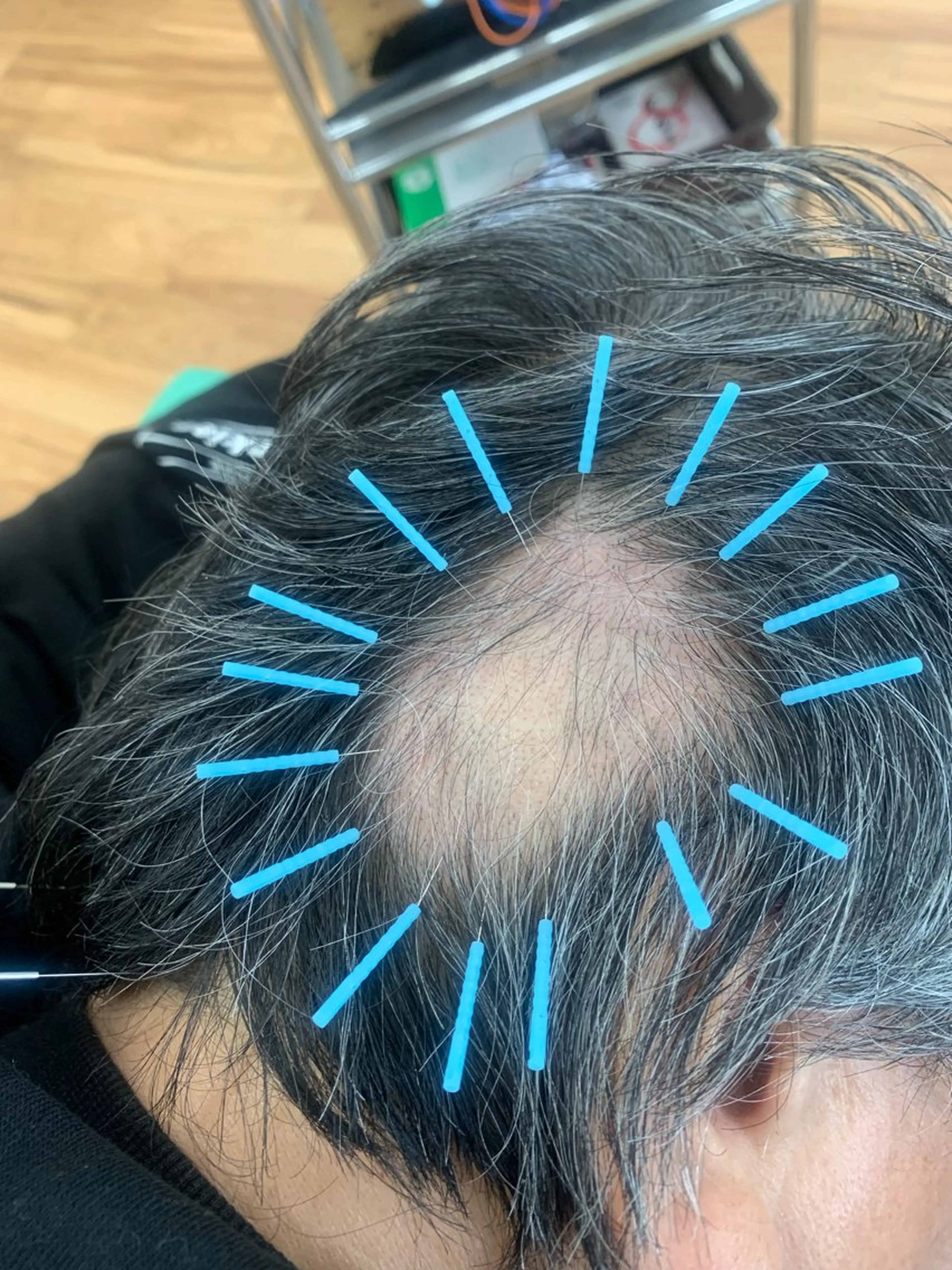 リラク 河輪 鍼灸接骨院のエステ・リラクイメージ