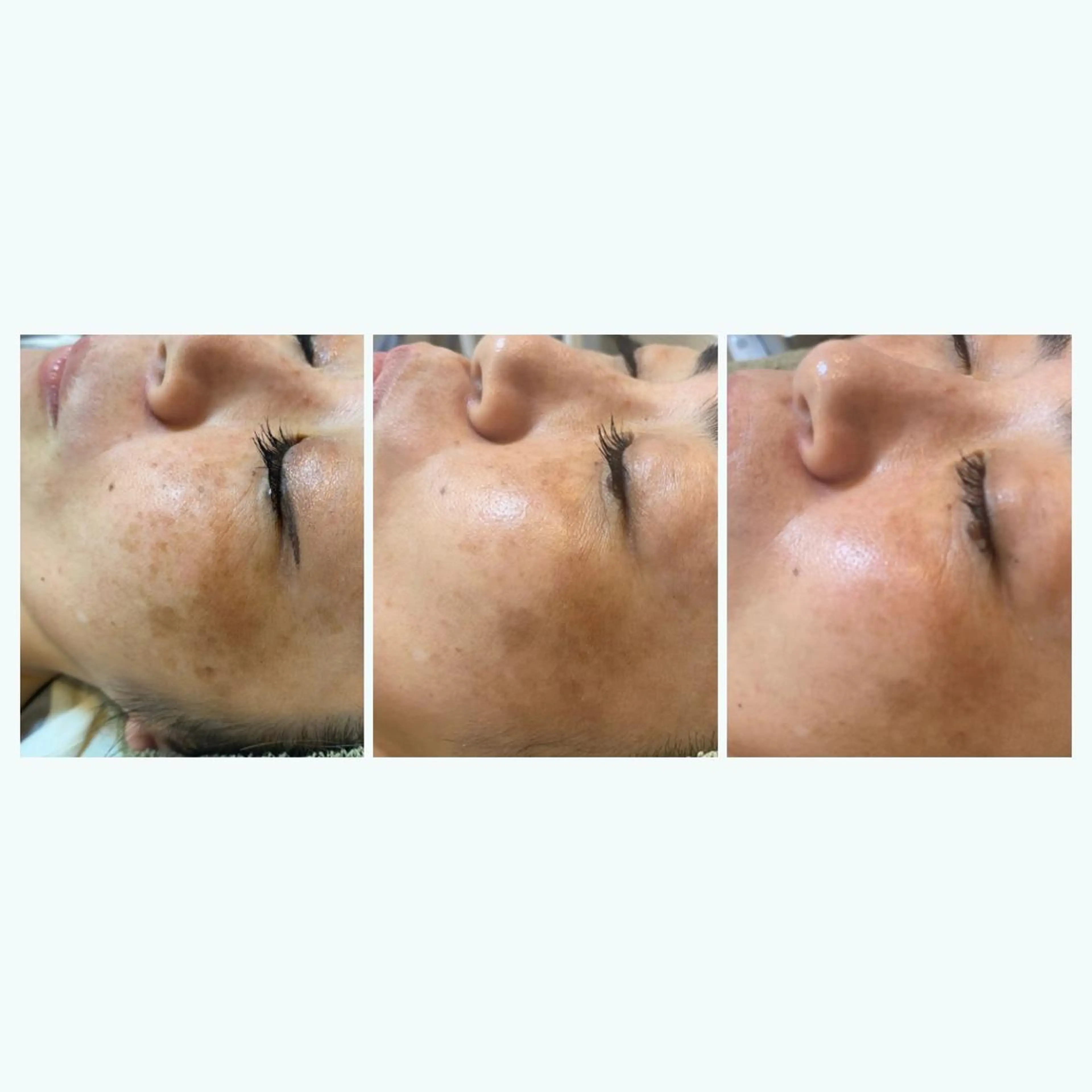 脱毛|ピーリング ROOM.Sのエステ・リラクイメージ