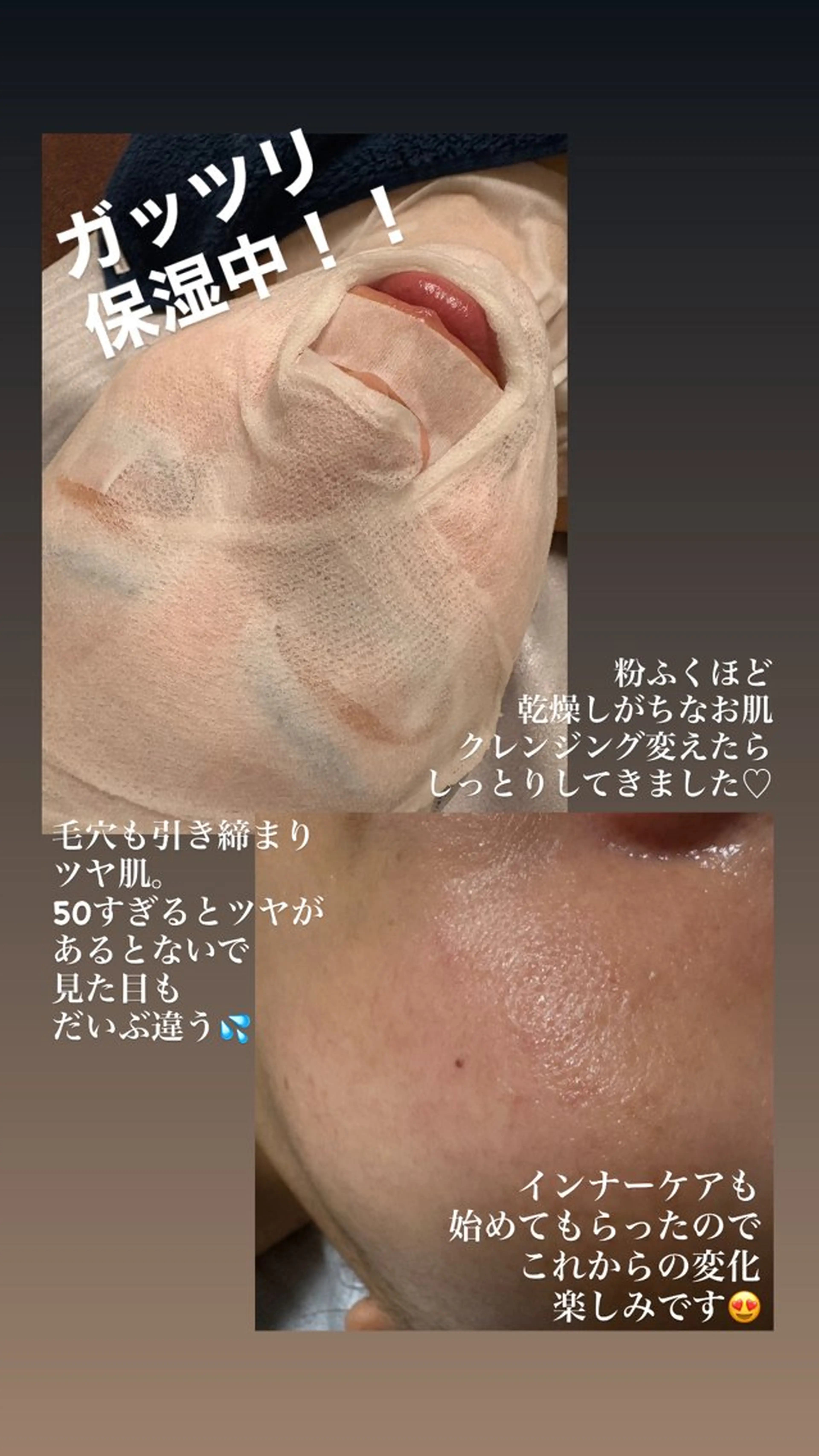 エステ フェイシャルエステ Turquoiseのエステ・リラクイメージ