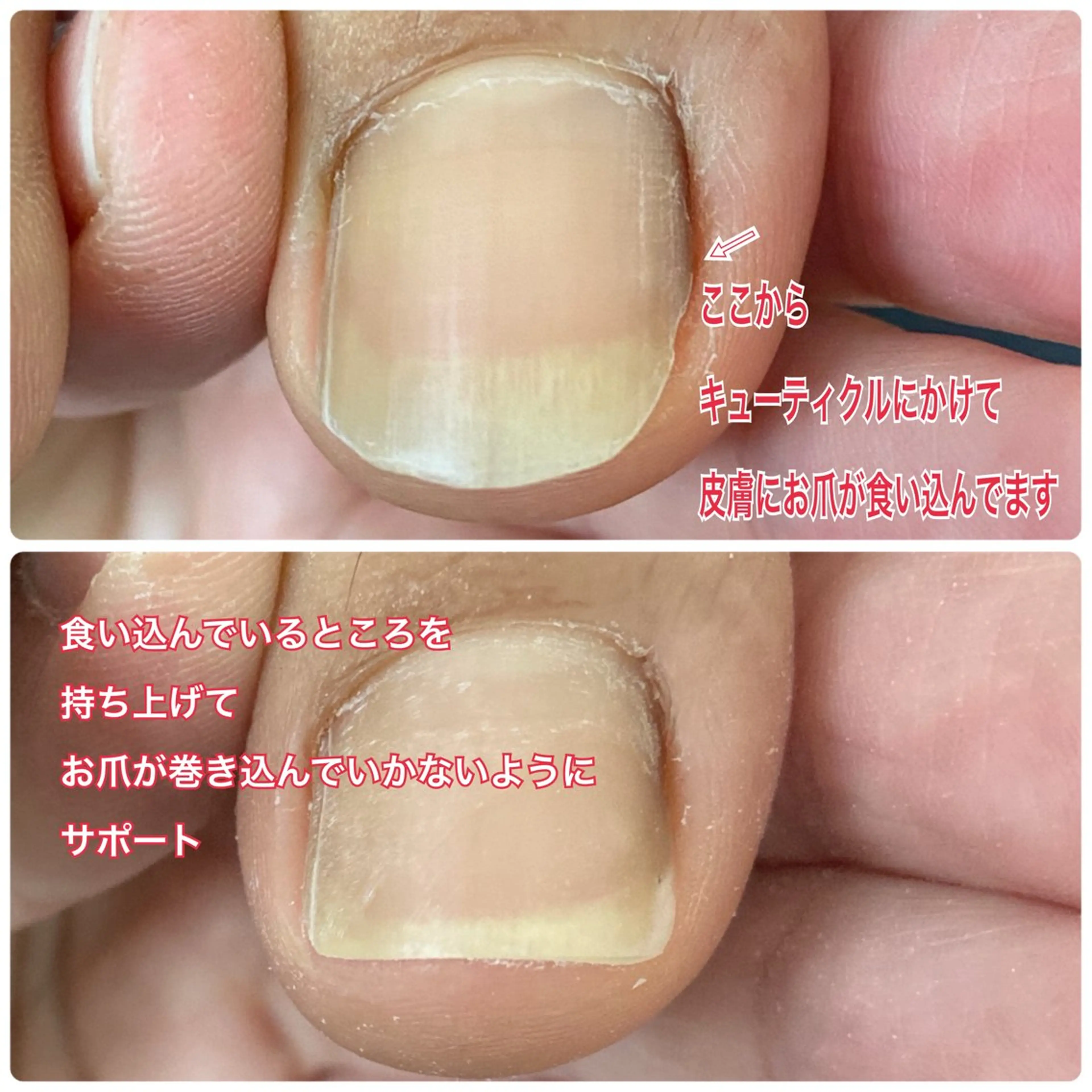 ネイル フットネイル ジェルネイル Lotus Nailのネイルデザイン