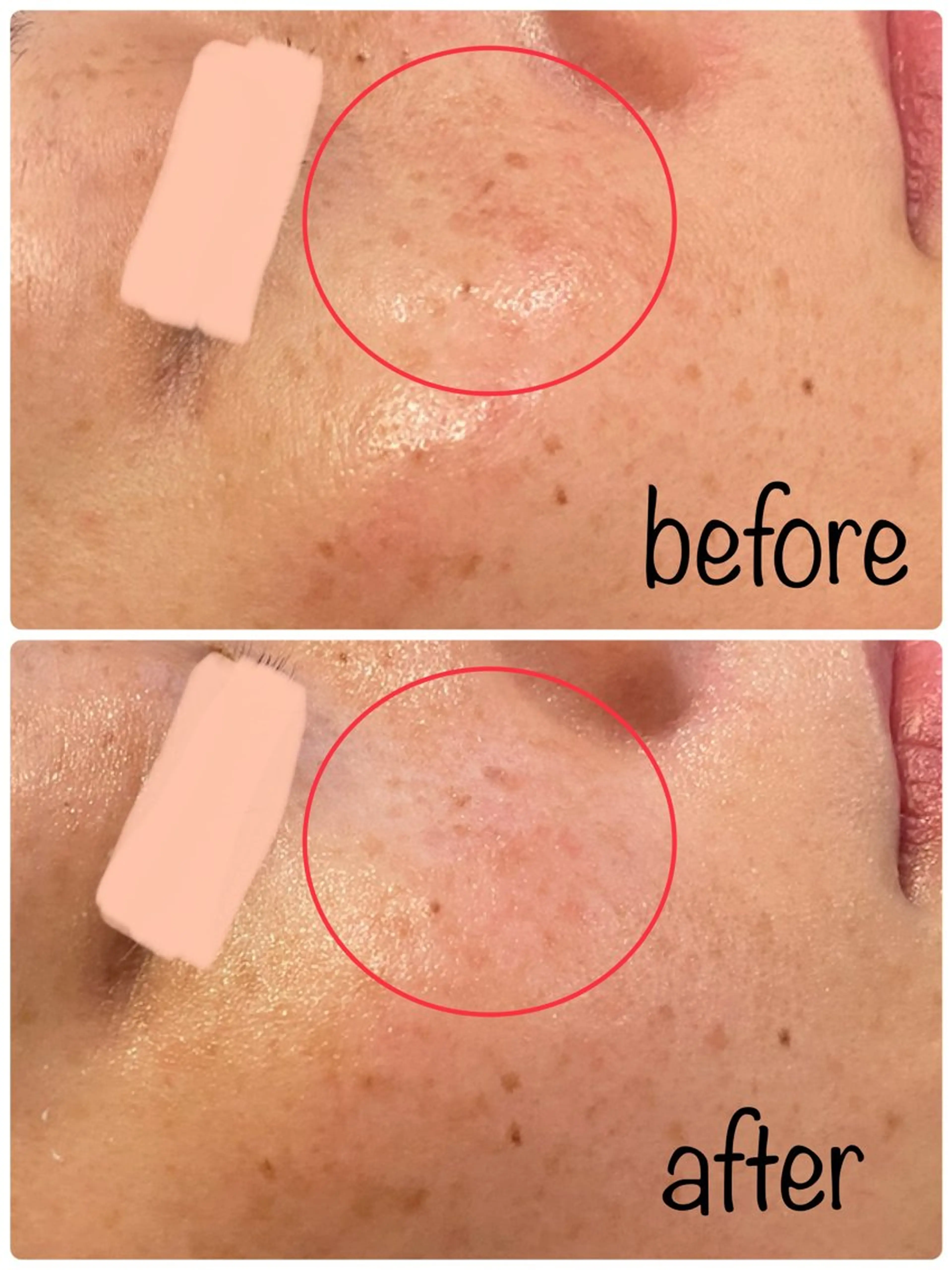 Hisui 小出のエステ・リラクイメージ