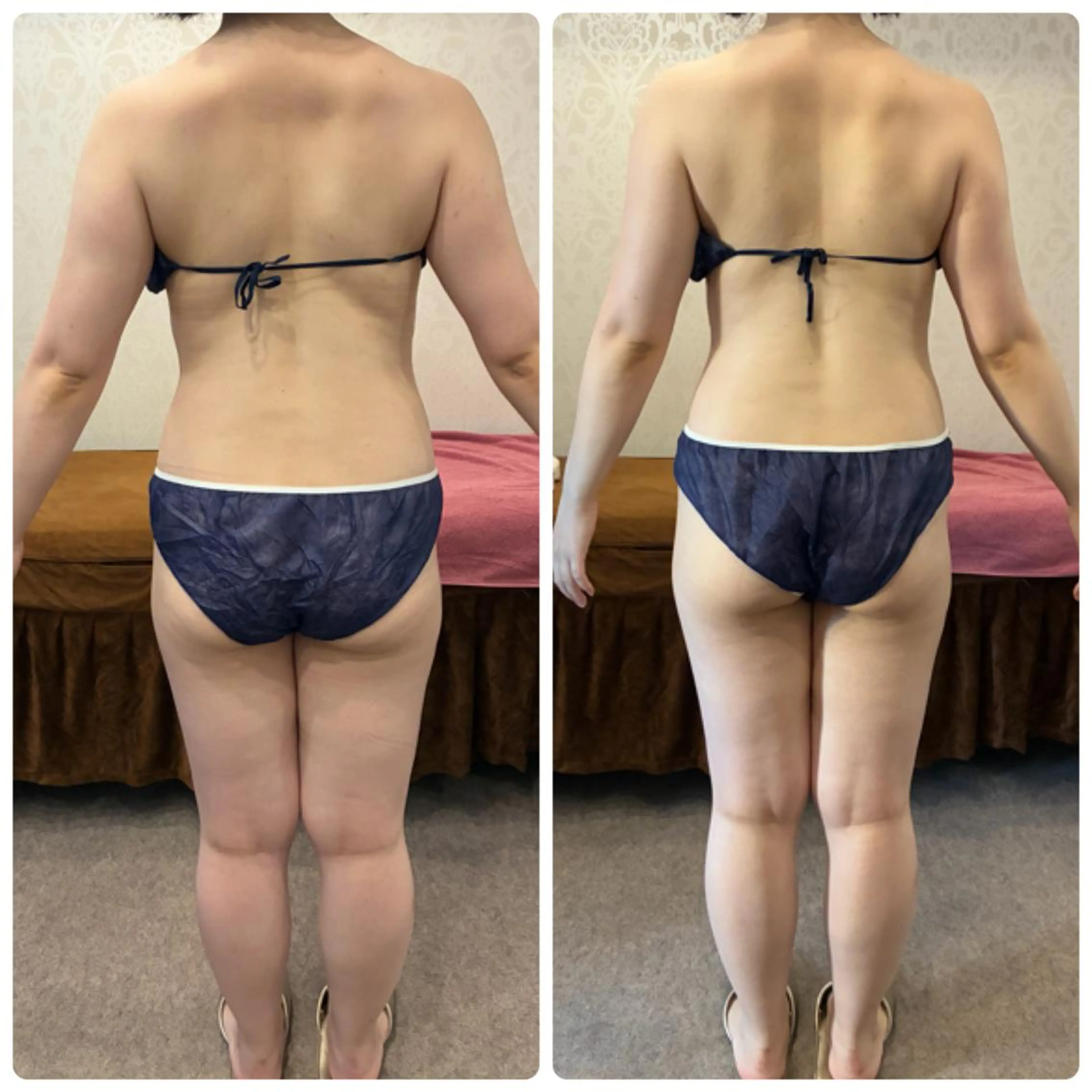 FLEURフェイシャ ル🫧ハーブ🌿小顔のエステ・リラクイメージ