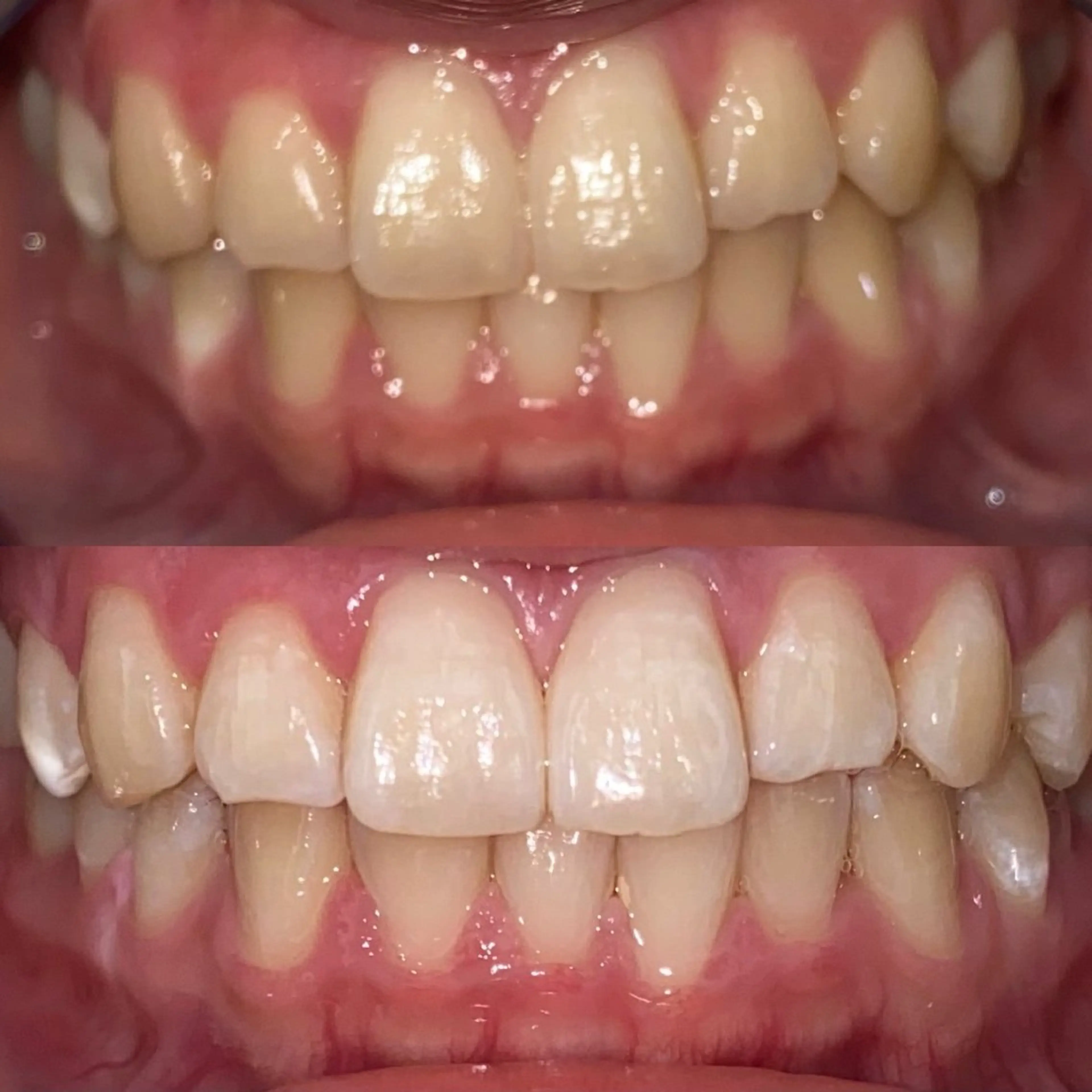 ホワイトニングサロンaile所属・セルフホワイトニング 金城しおりのその他イメージ