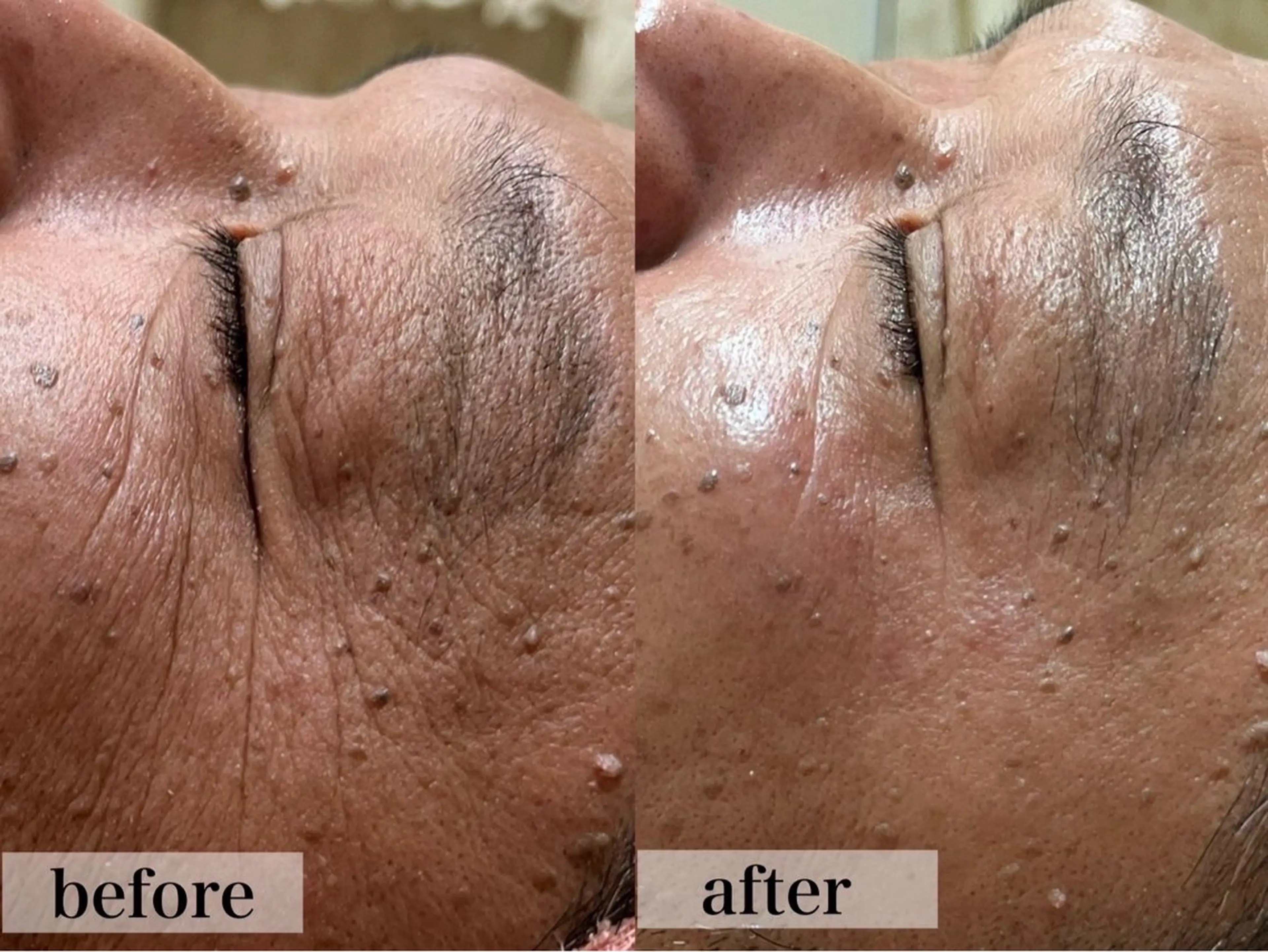 エステ フェイシャル/脱毛 ジョアアンジェ竹田のエステ・リラクイメージ