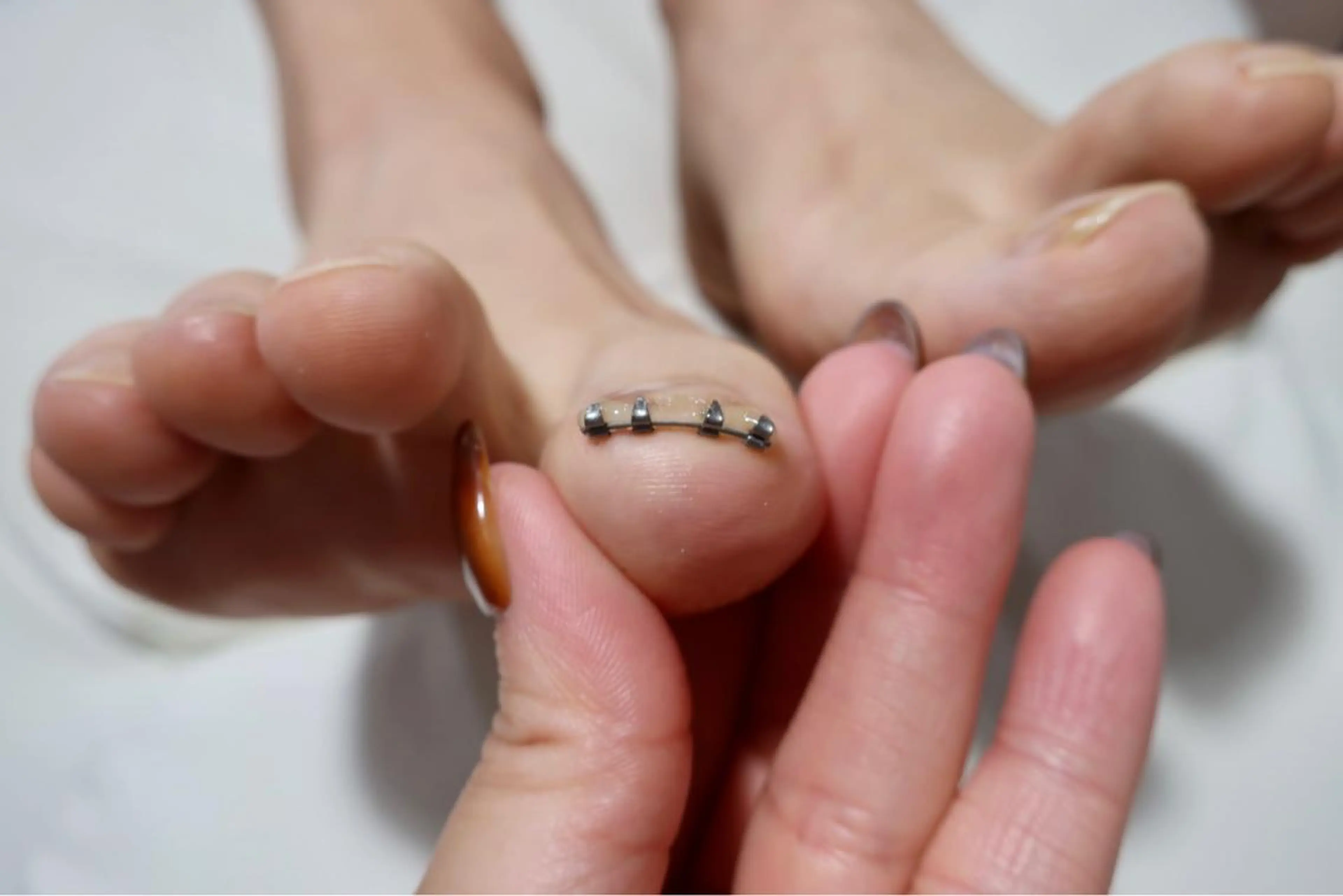 ネイル フットネイル nail salon ワンミリオンのネイルデザイン