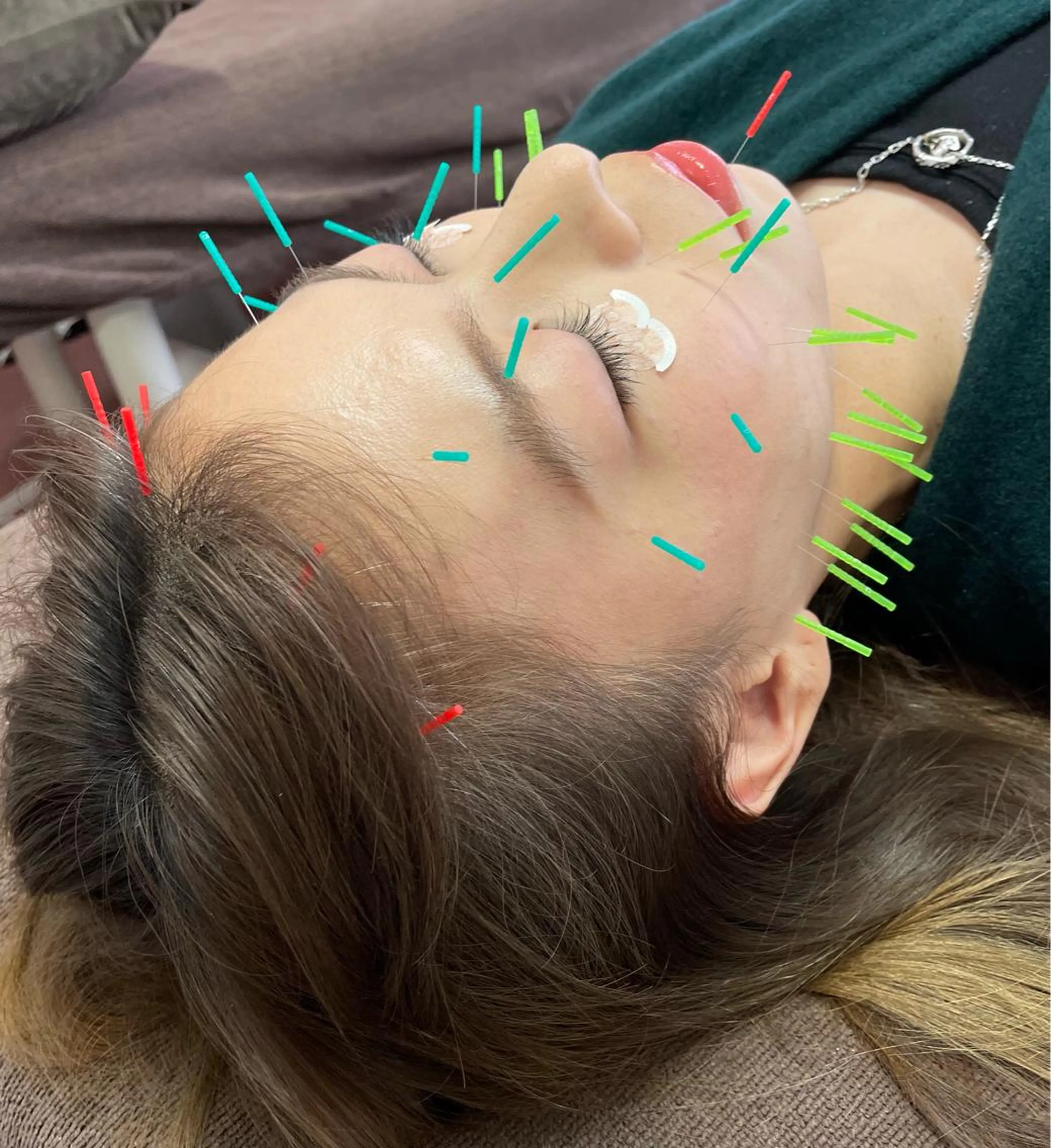 同心整骨院 美容鍼・整体・小顔のエステ・リラクイメージ