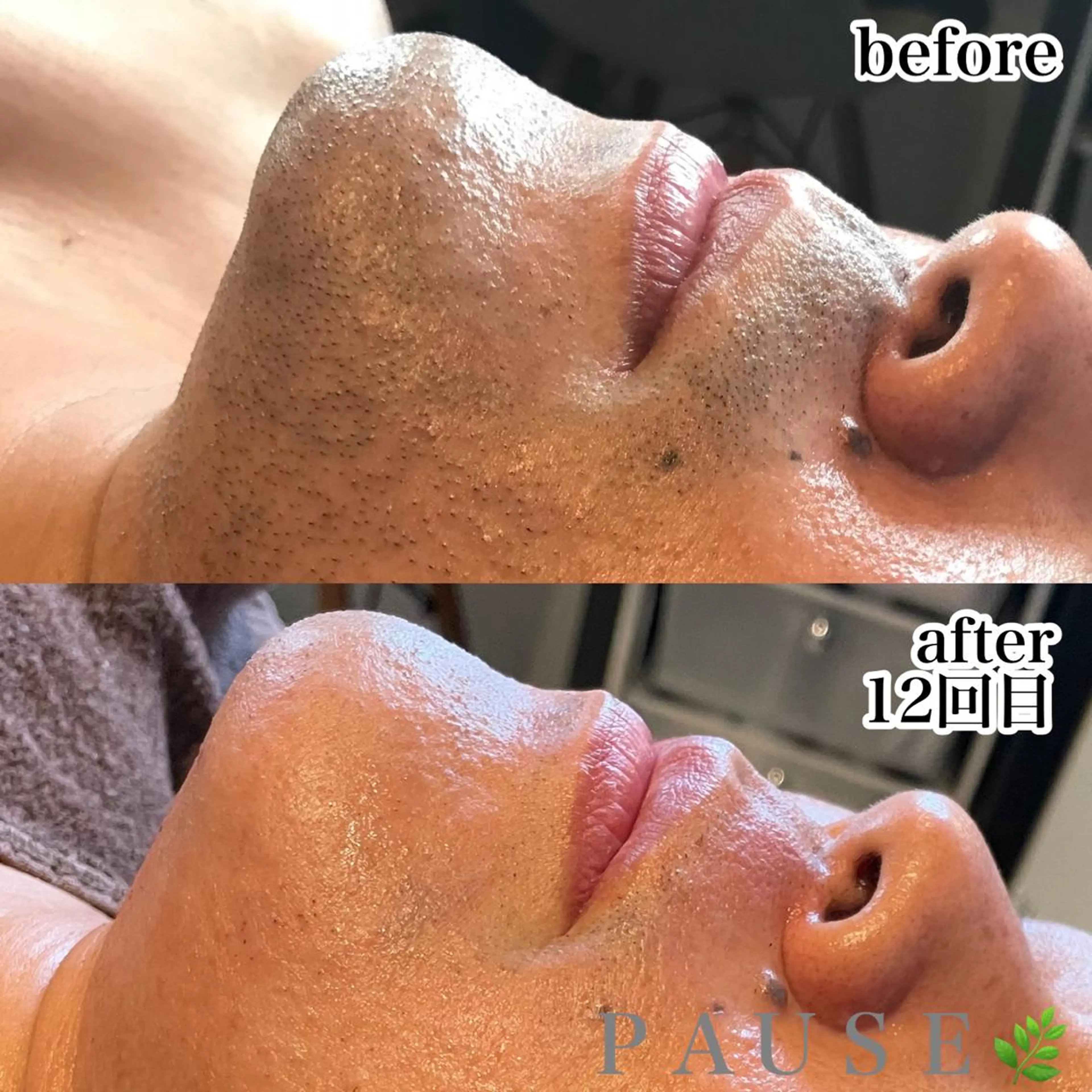 脱毛 浜野 恵美のエステ・リラクイメージ