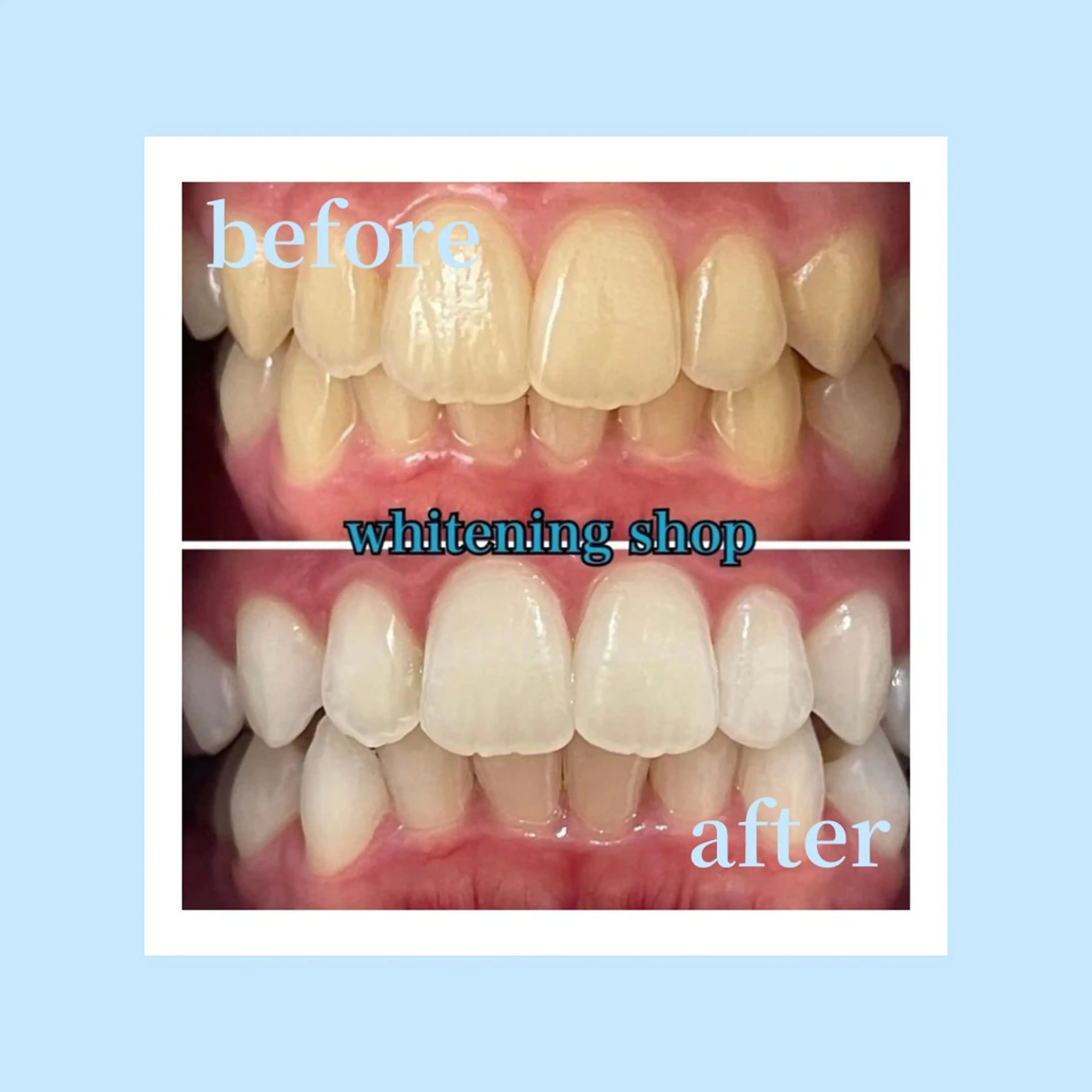 ホワイトニングショップ光明池店所属・ホワイトニング ショップ光明池店のエステ・リラクイメージ