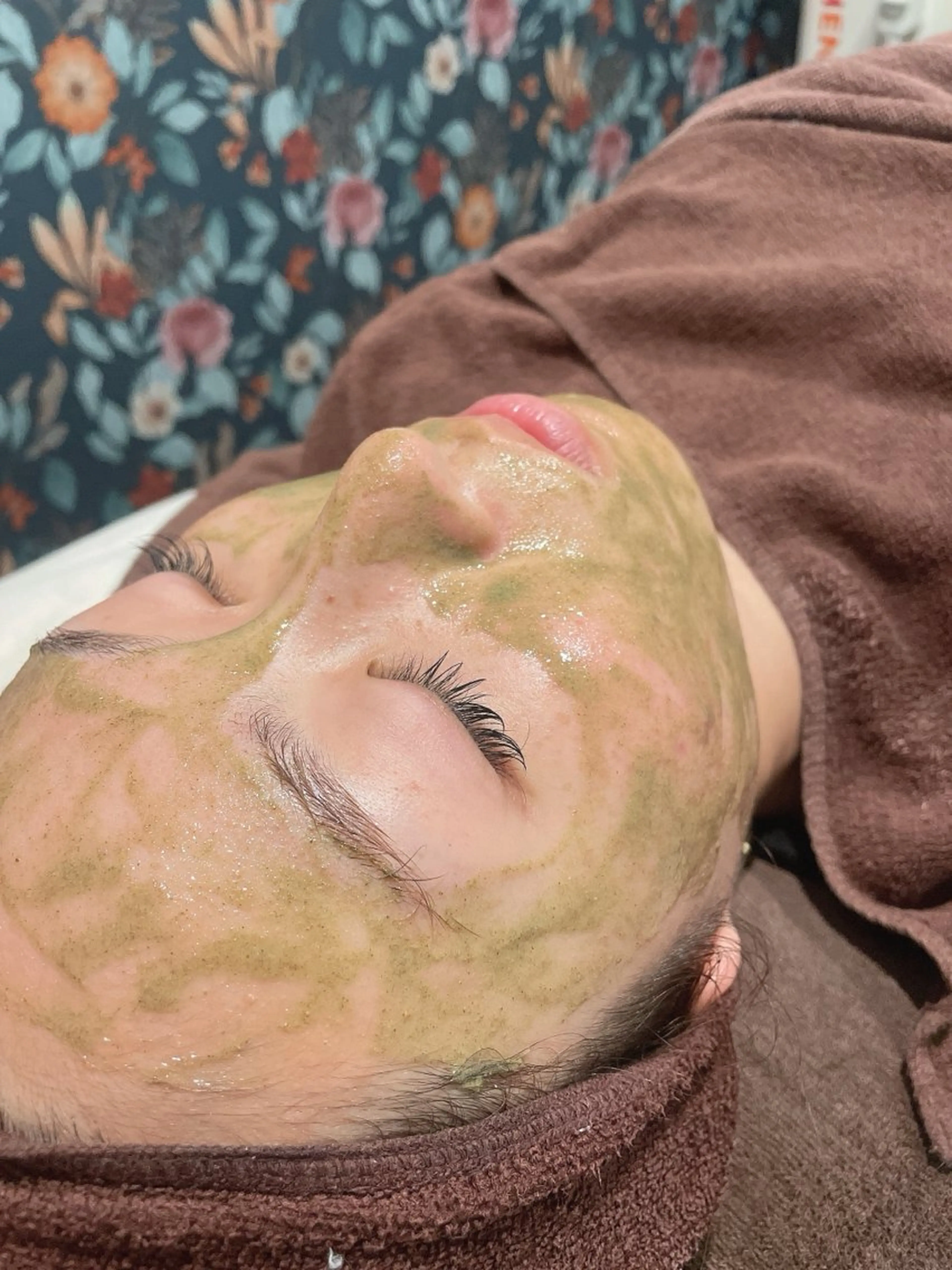 大人気！【ニキビケア】剥けないハーブピーリング🌿‬￥5,500✨️の写真