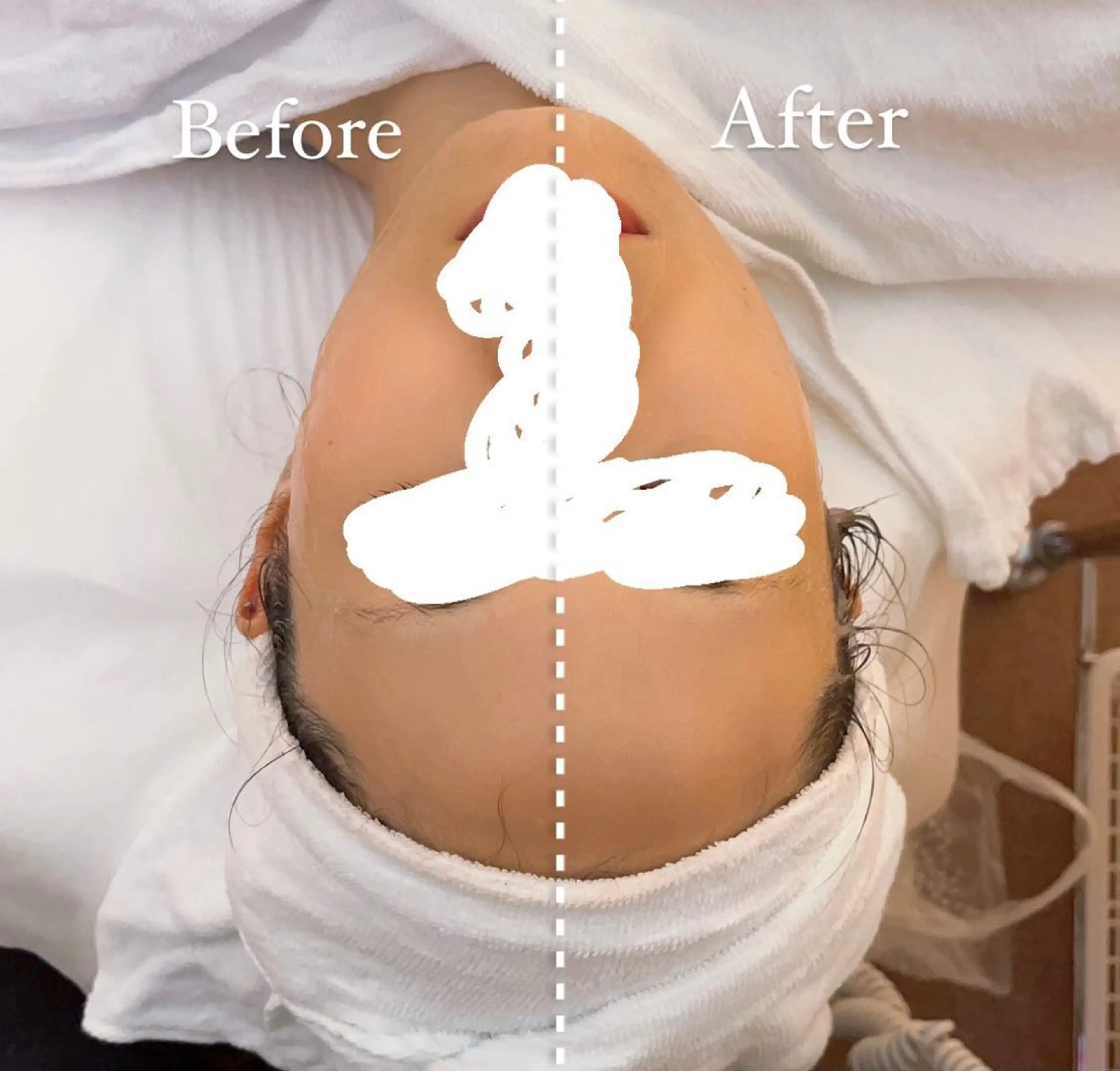 肌質改善サロン🌕 ⠀【ルーナピエナ】のエステ・リラクイメージ