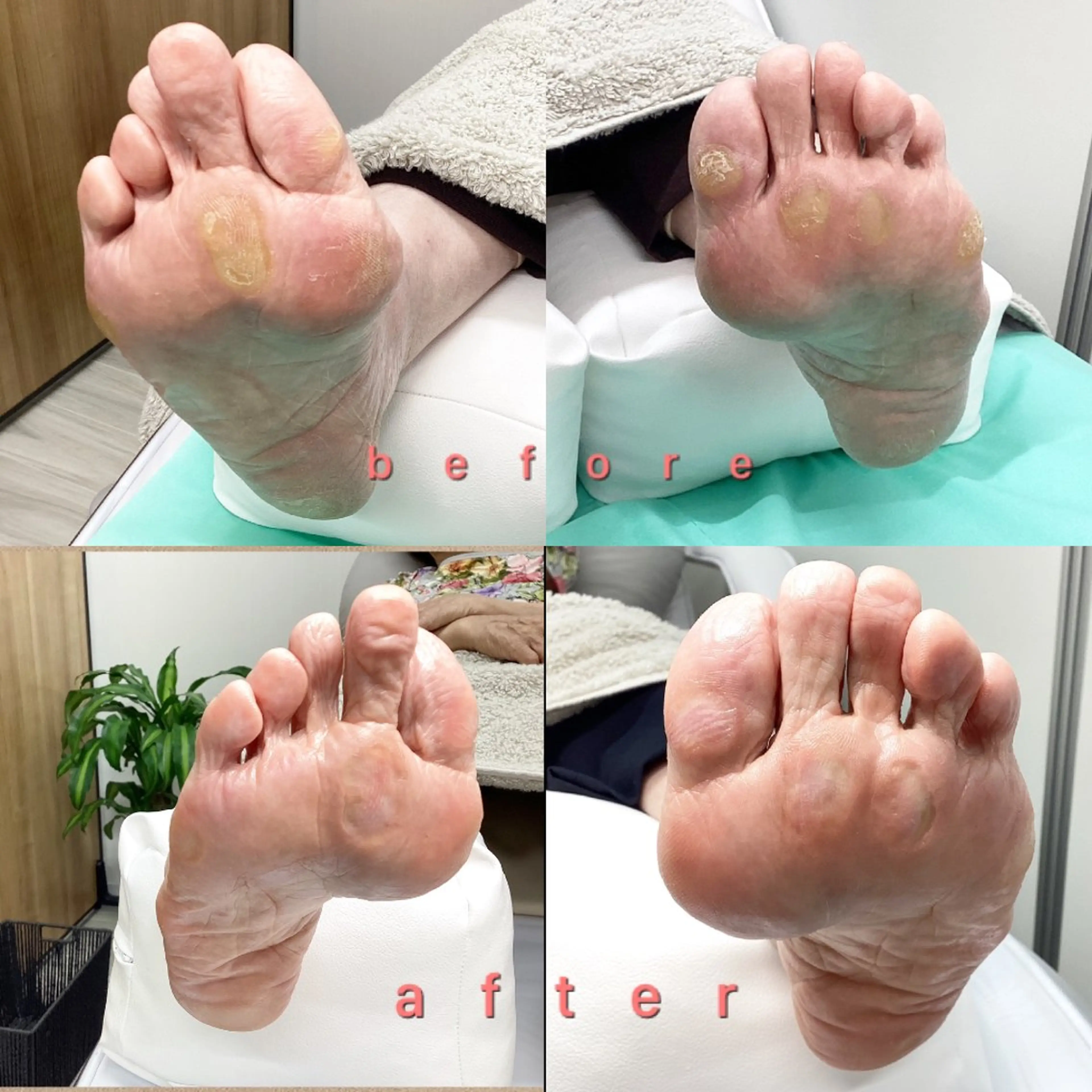 巻き爪補正店 大阪なんば店のネイルデザイン