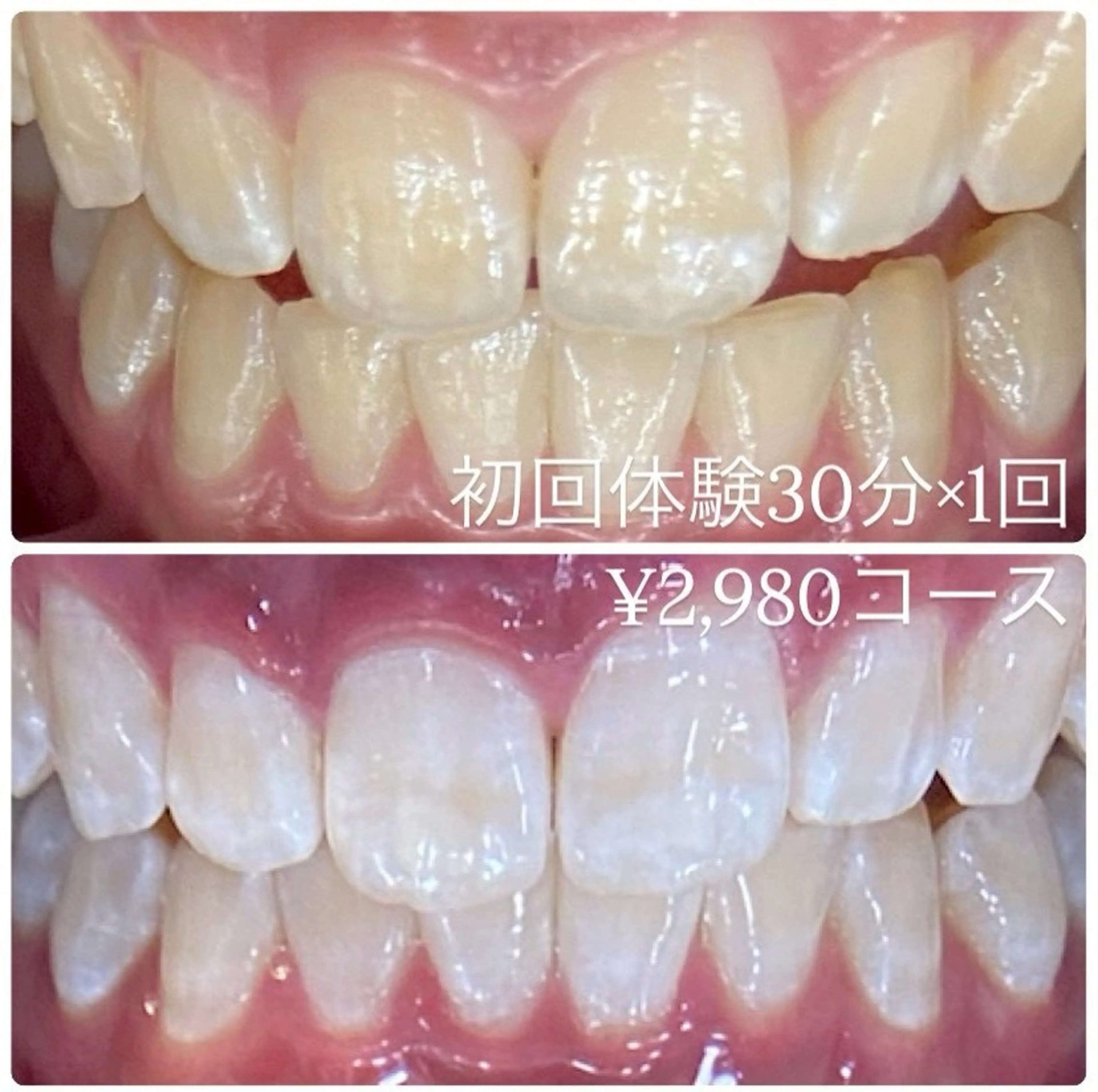 メンズ その他 ホワイトニングルーム　川崎店所属・ホワイトニング ルーム　川崎店のその他イメージ