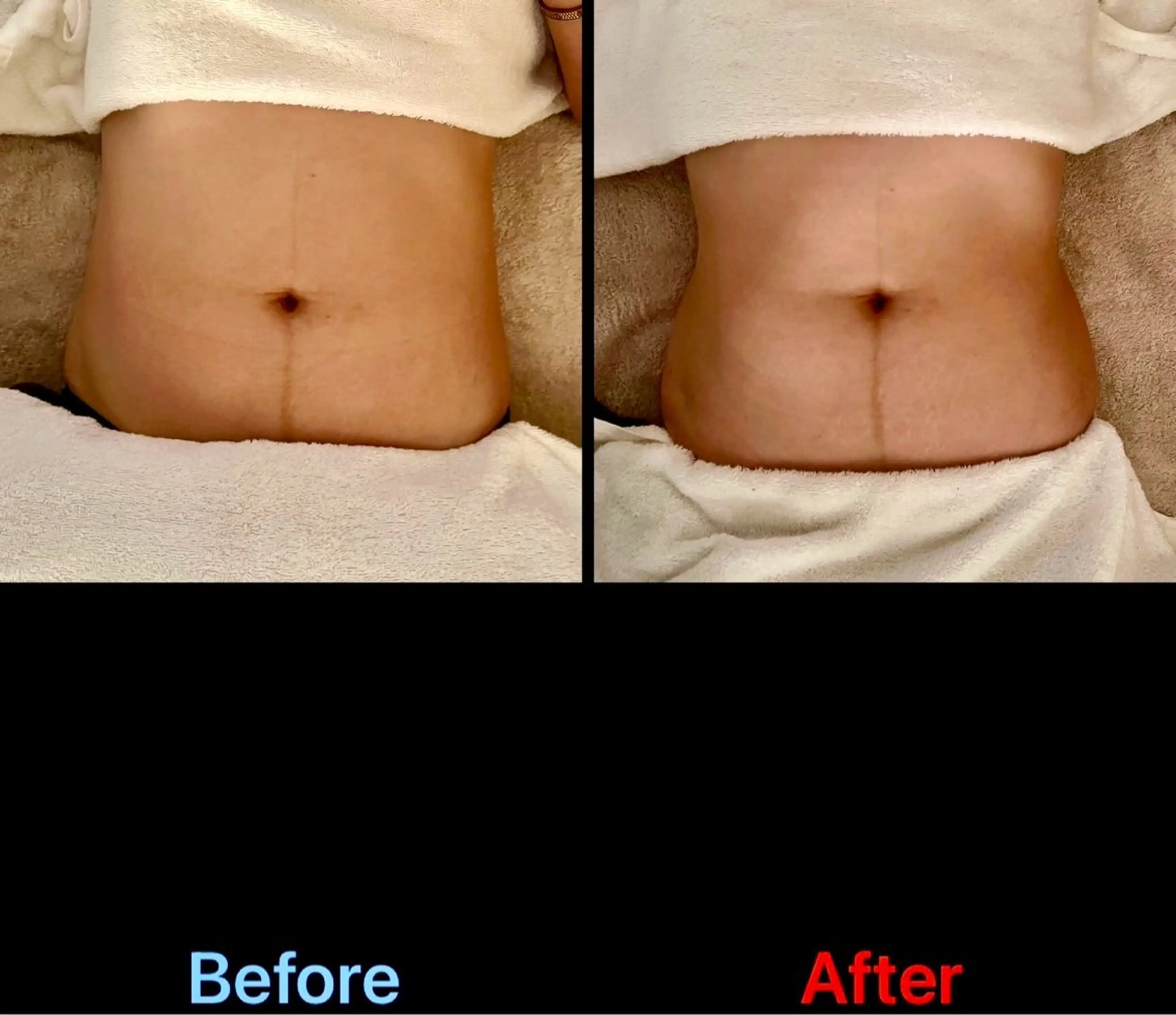 lumirise viblissのエステ・リラクイメージ