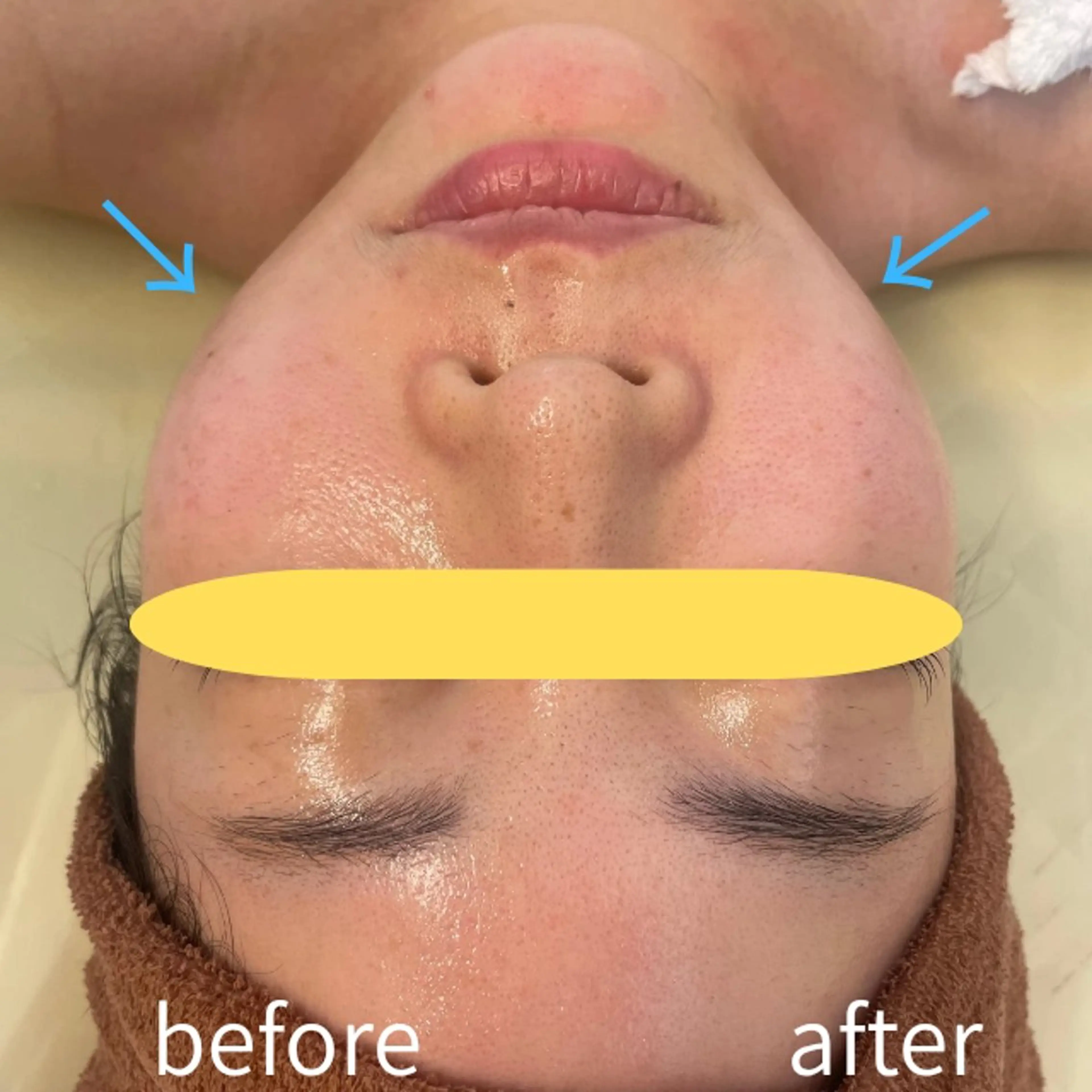 エステ aliaハイフ&水光ジェットサロン所属・aliaハーブ水光店 エステティシャン募集のエステ・リラクイメージ