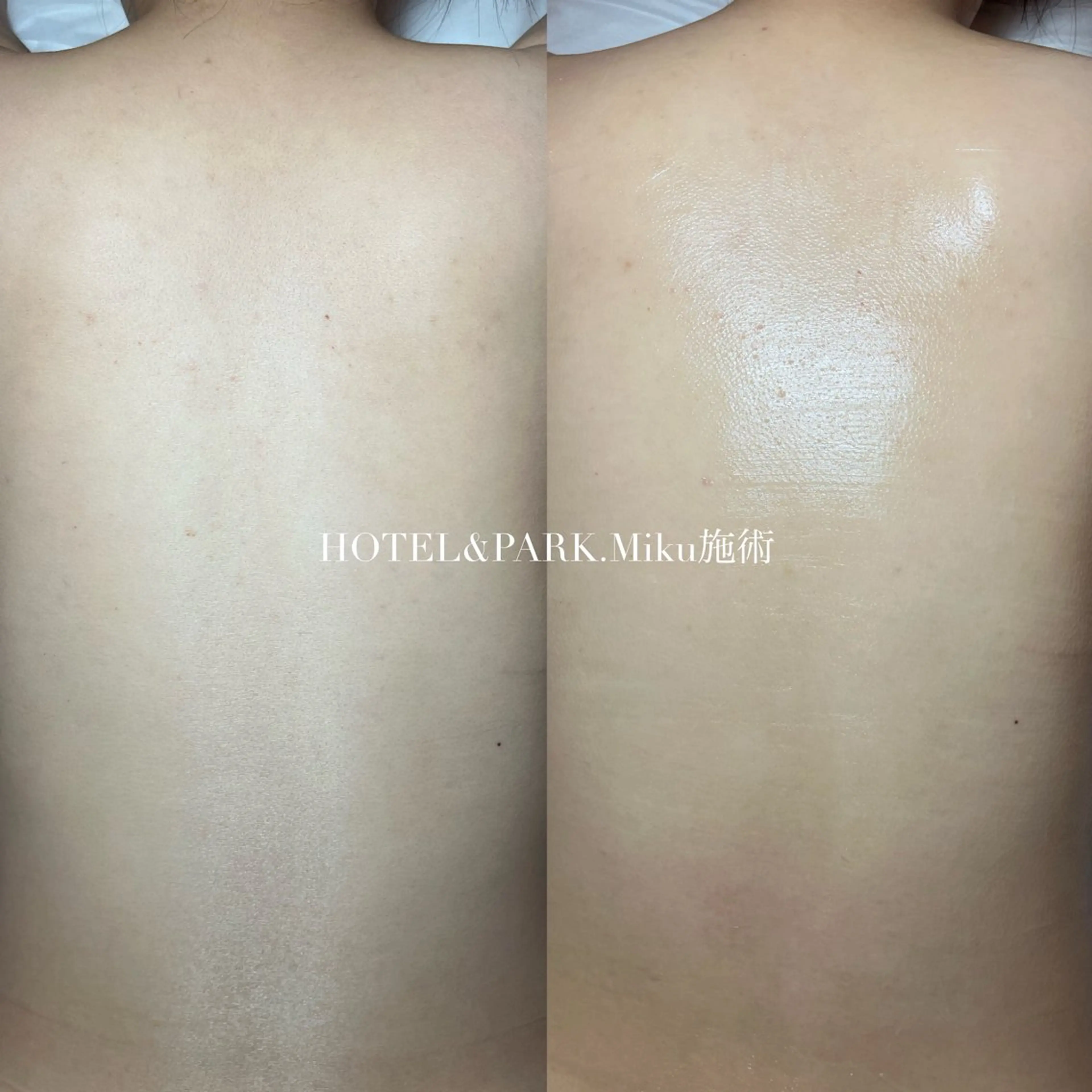 HOTEL&PARK Mikuワックス脱毛のエステ・リラクイメージ