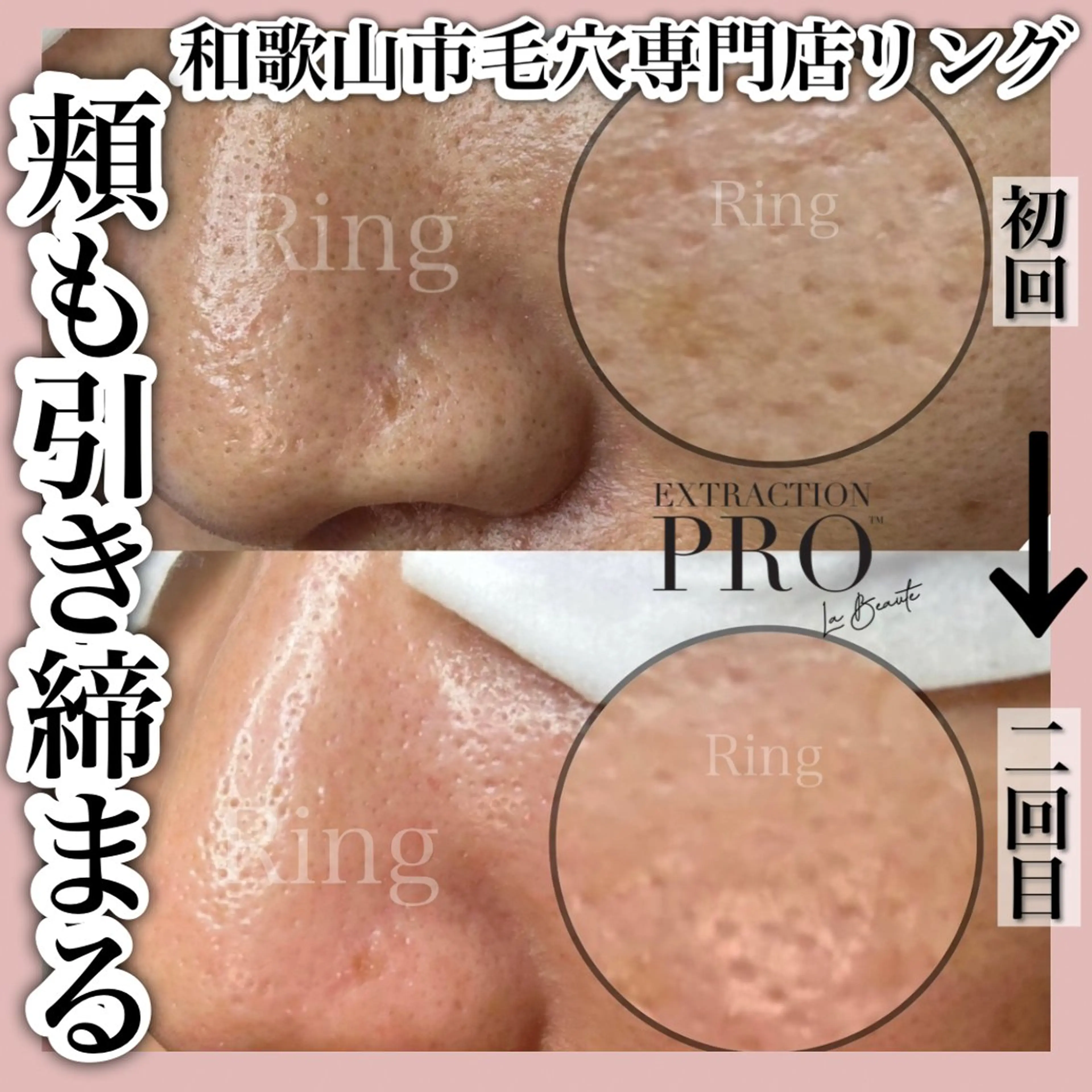 和歌山　毛穴専門店 Ringのエステ・リラクイメージ