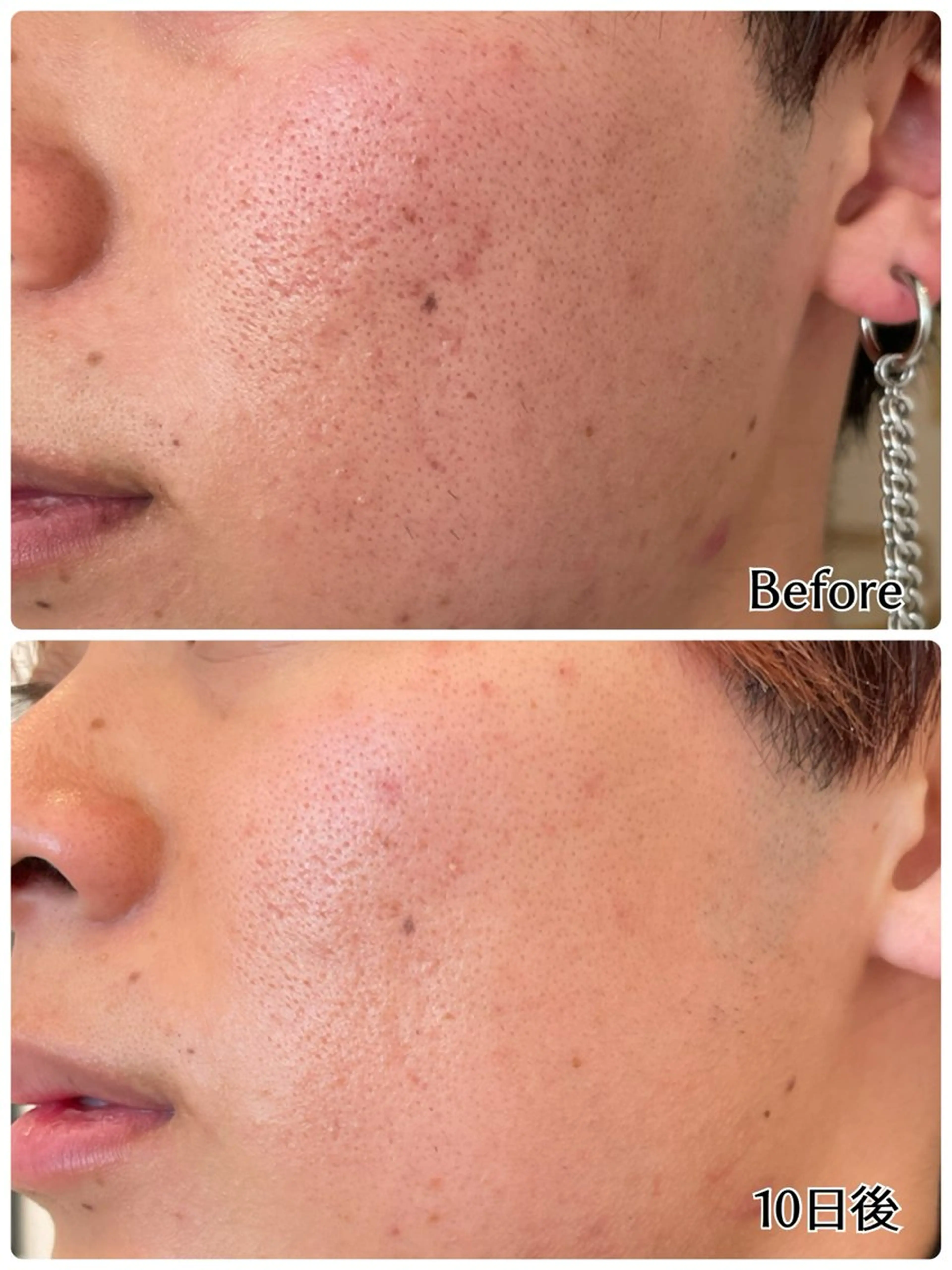 むくみ専門痩身 マクイエステティックのエステ・リラクイメージ