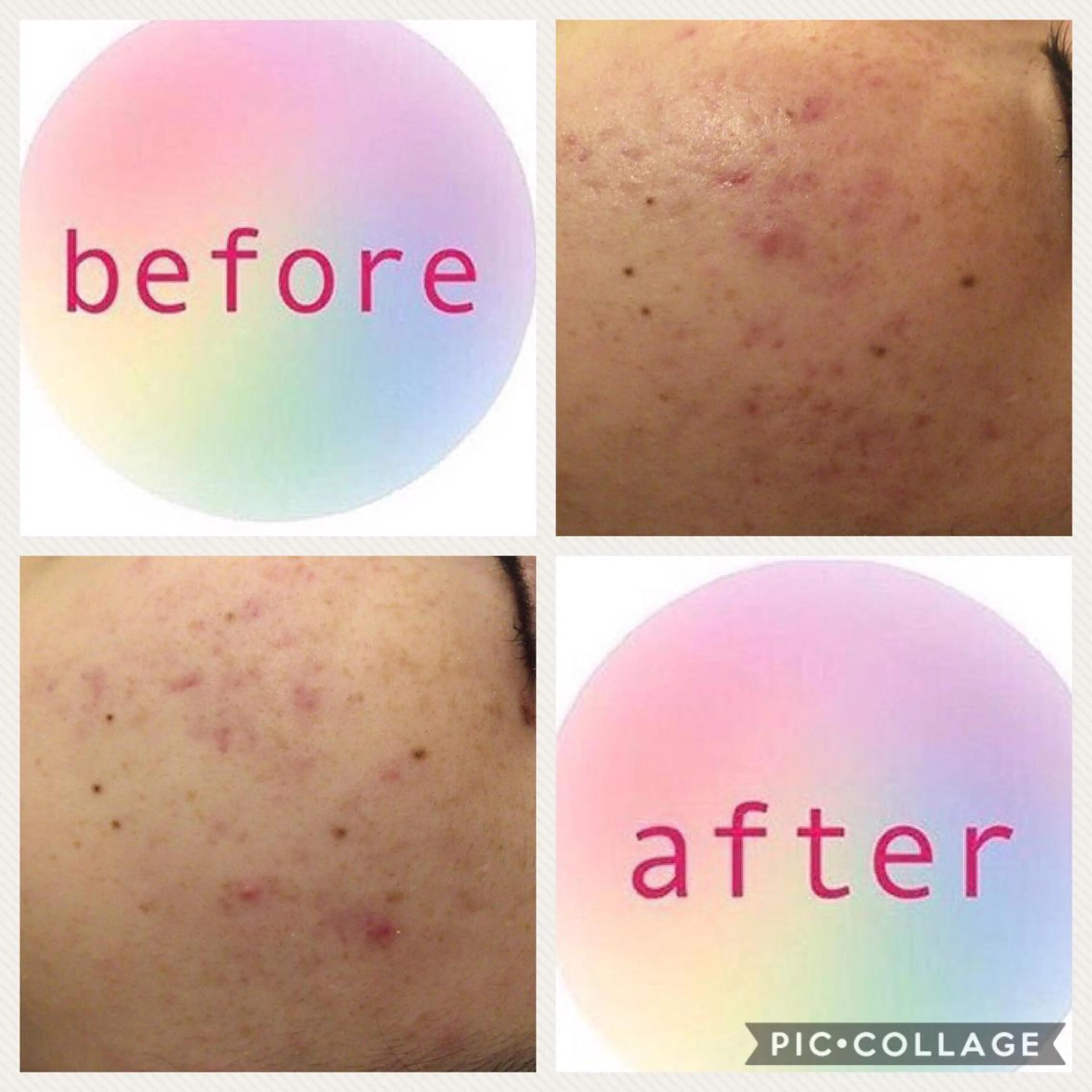 ミディアム カラー パーマ ヘアアレンジ メンズ キッズ ネイル マツエク・マツパ ニキビ・肌質改善専門 ♡人生が変わるサロンのエステ・リラクイメージ