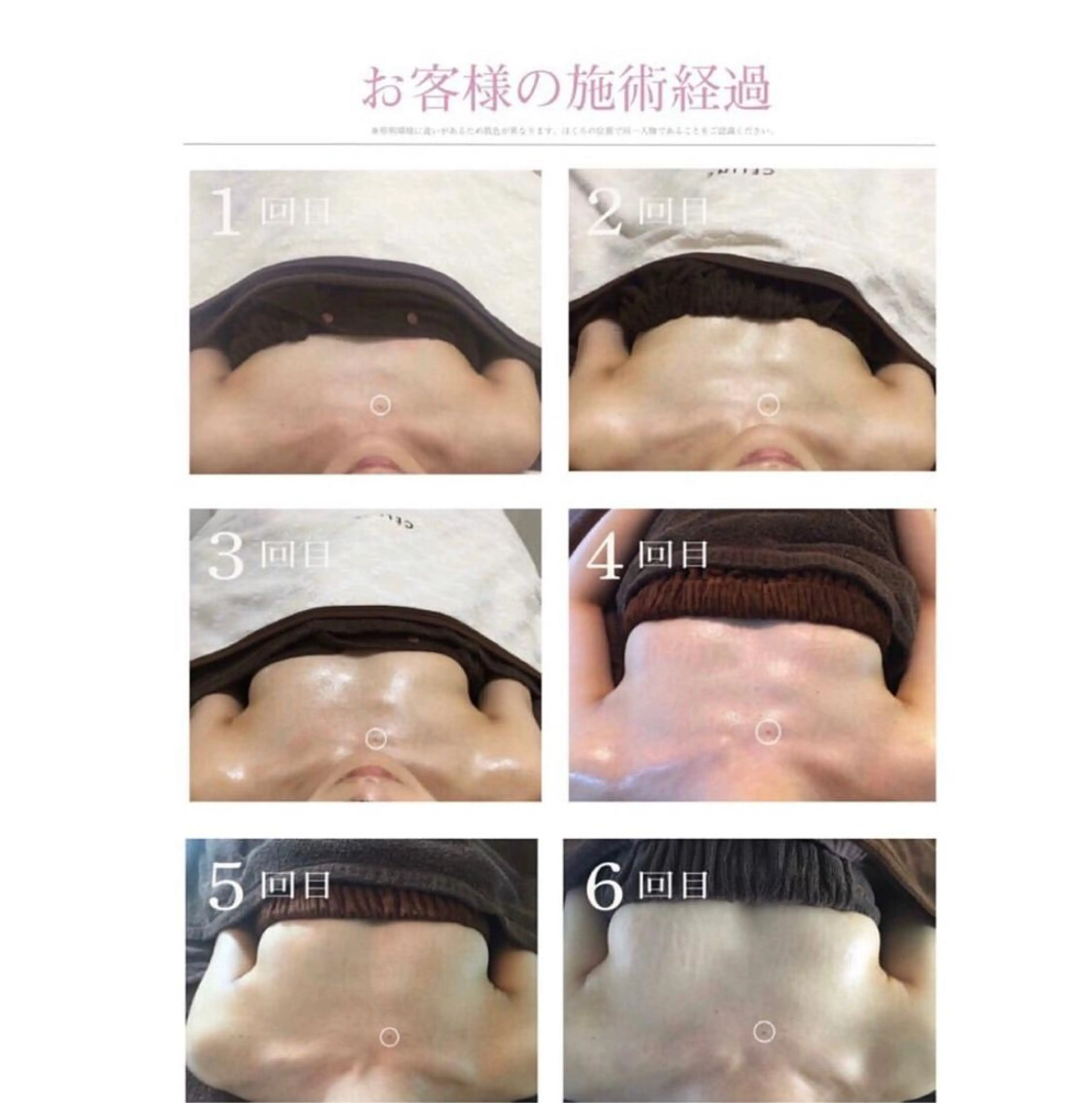 snow flakeのエステ・リラクイメージ