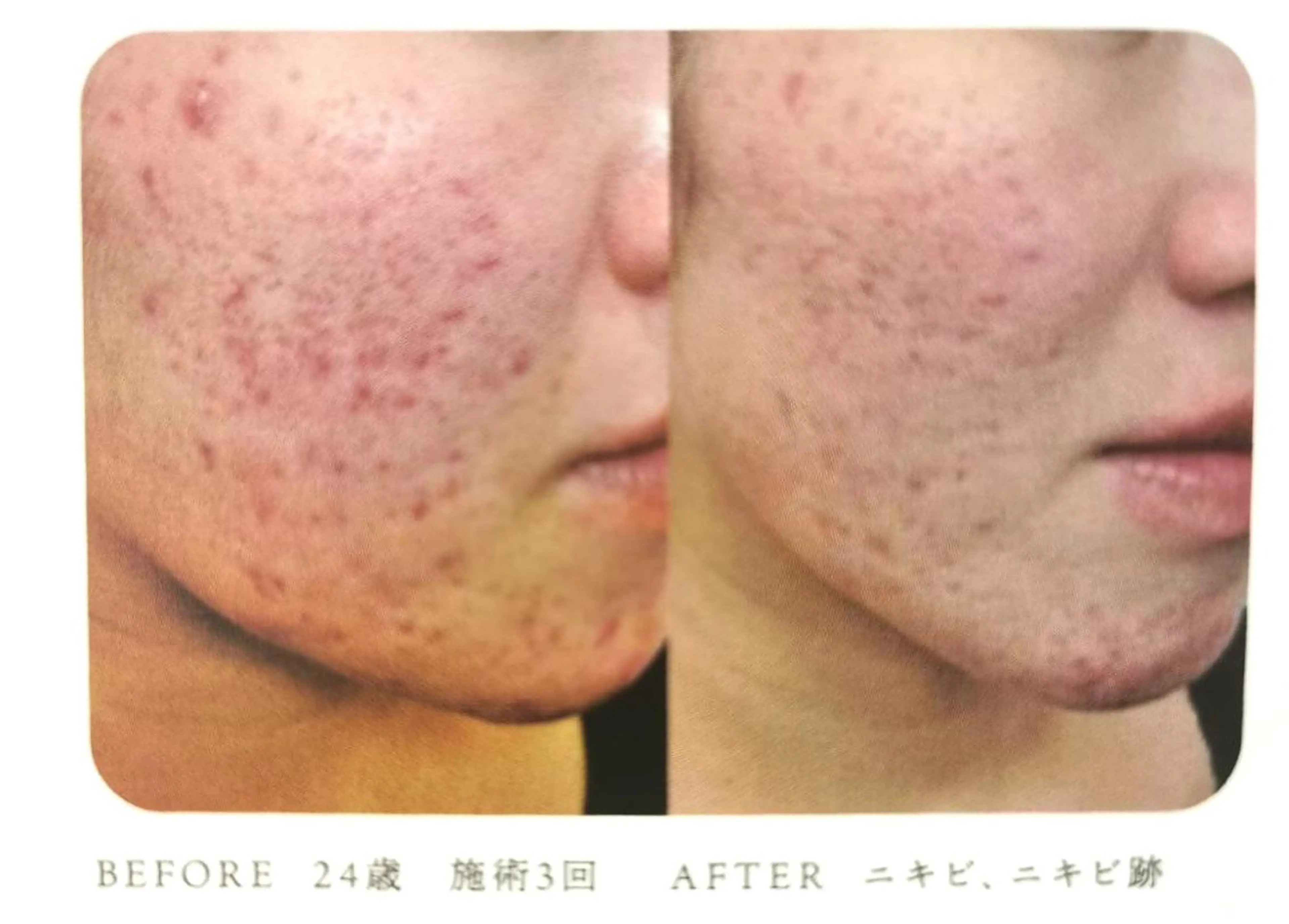 むくみ専門痩身 マクイエステティックのエステ・リラクイメージ