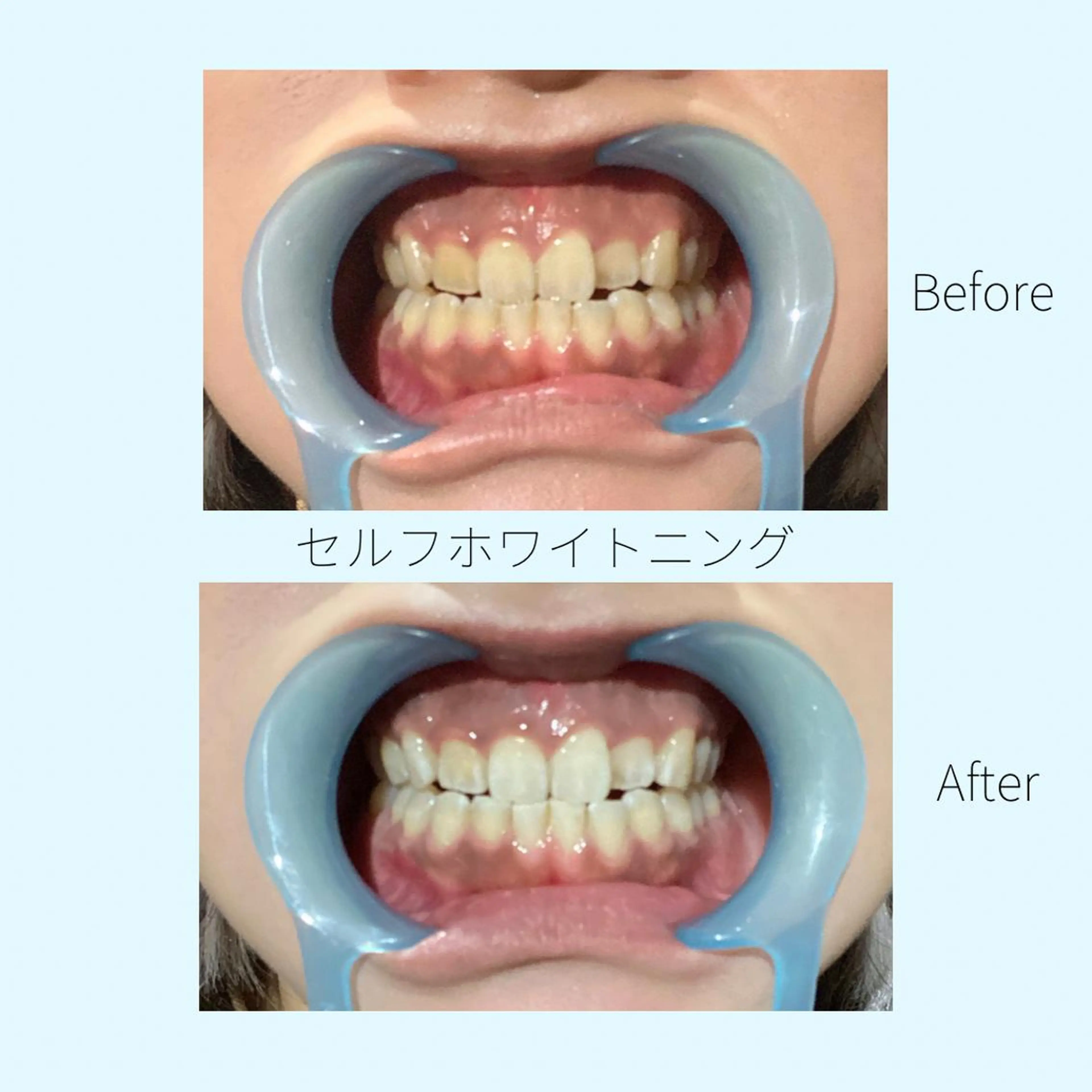 メンズ 男女同額完全個室脱毛 LEPIA内田のエステ・リラクイメージ