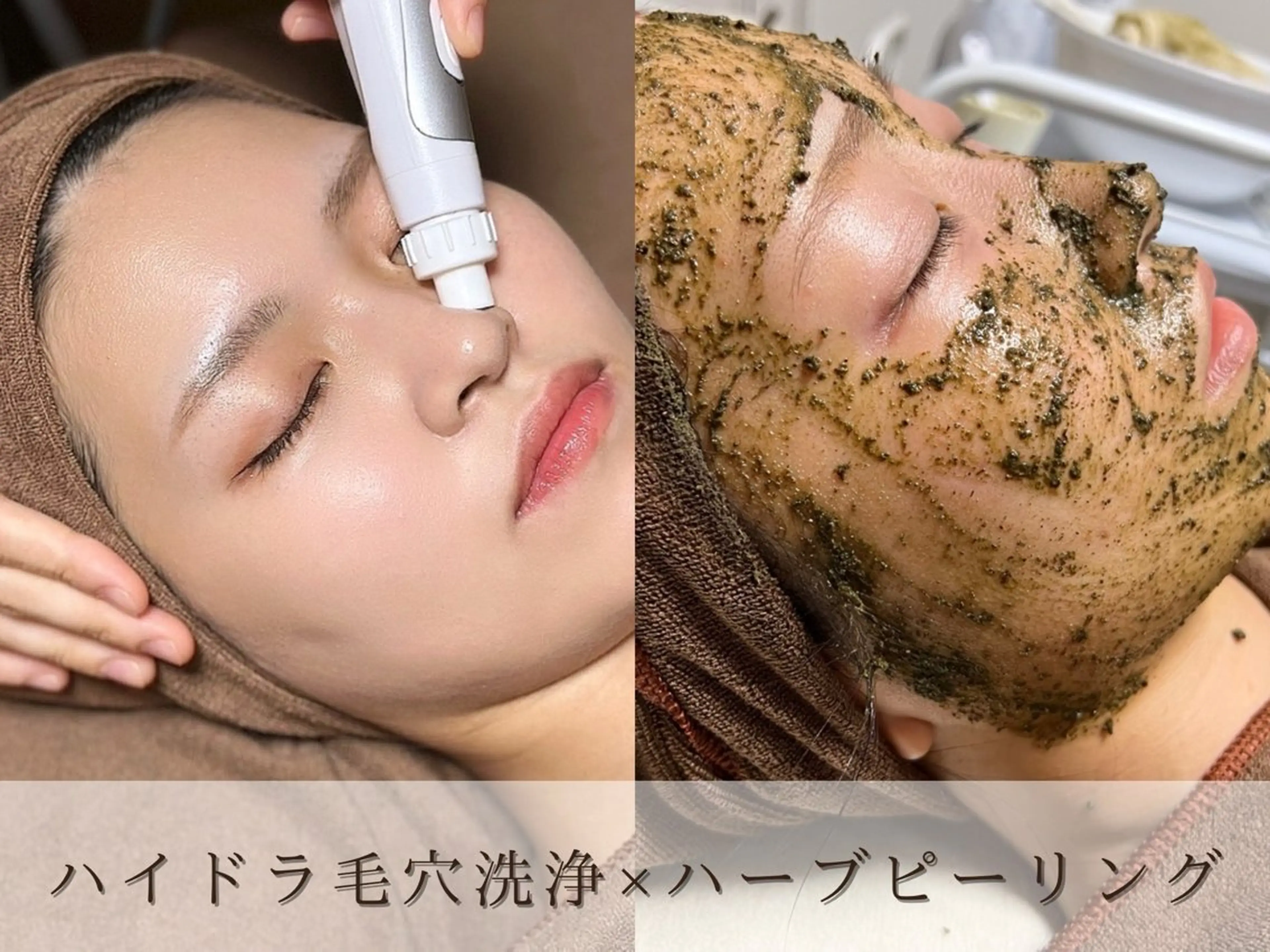 【毛穴/肌荒れ】ハイドラ毛穴洗浄＋4種類肌悩みから選べるピーリングの写真